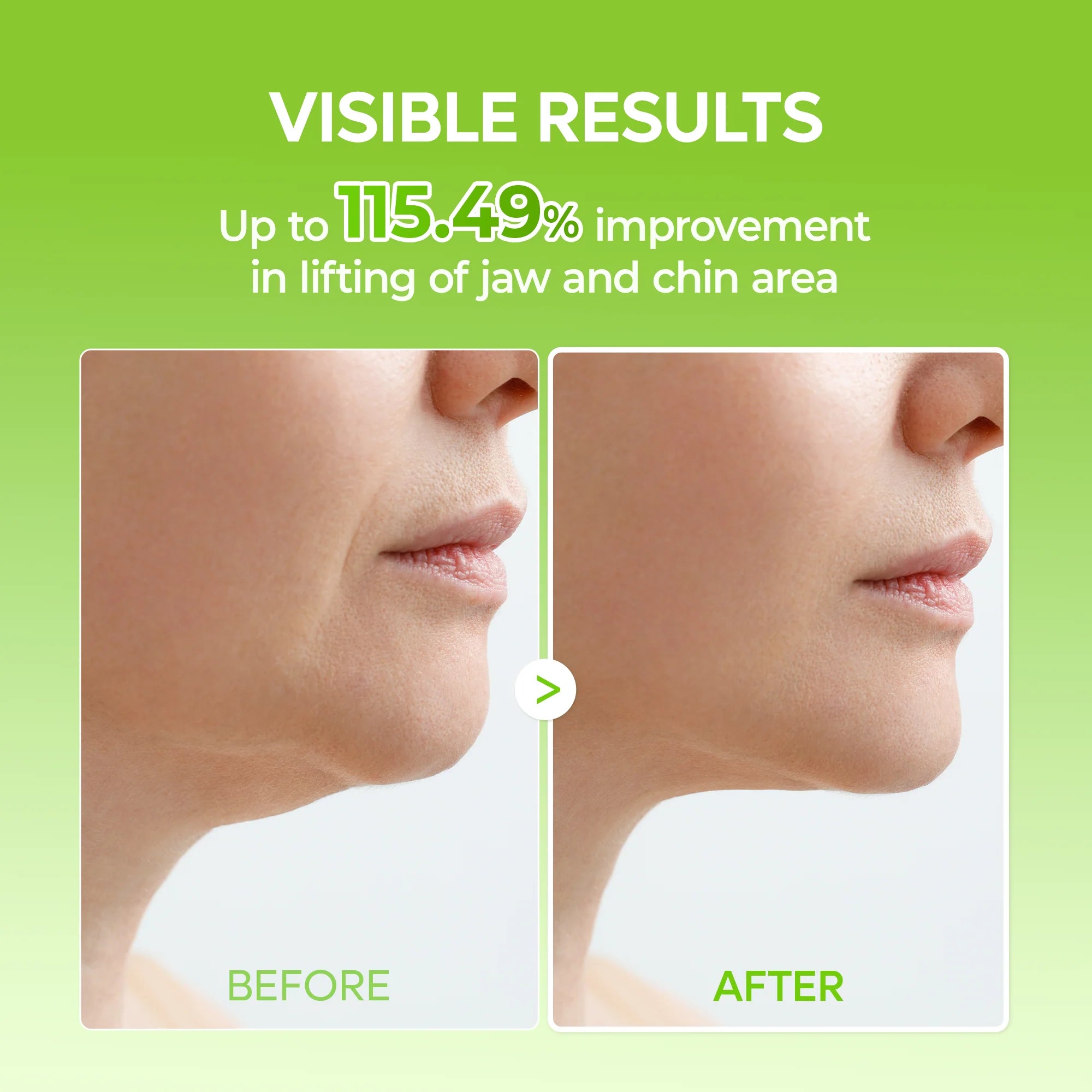 Dr.Melaxin Cactox V-Lifting Mewing Band — defined jawline