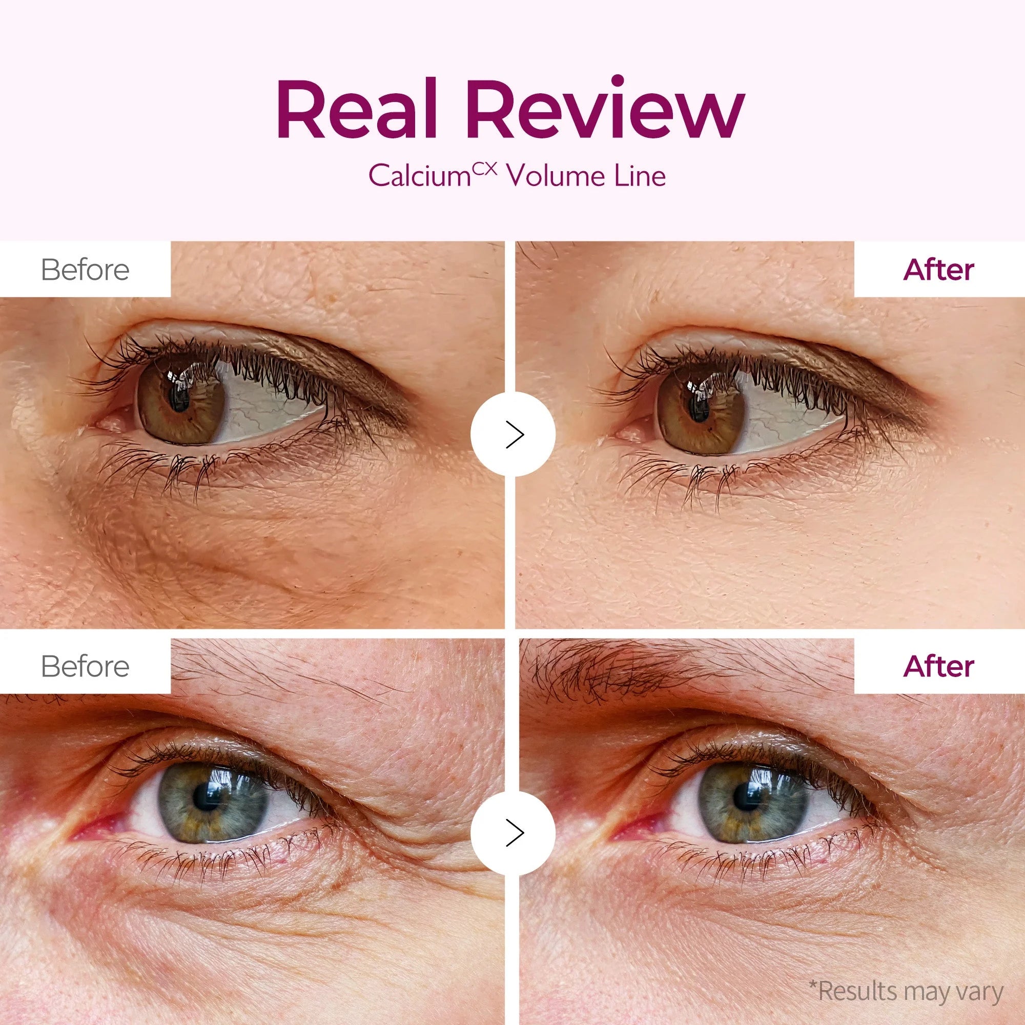 Dr.Melaxin Cemenrete Calcium Volume Eye Patch — calcium complex