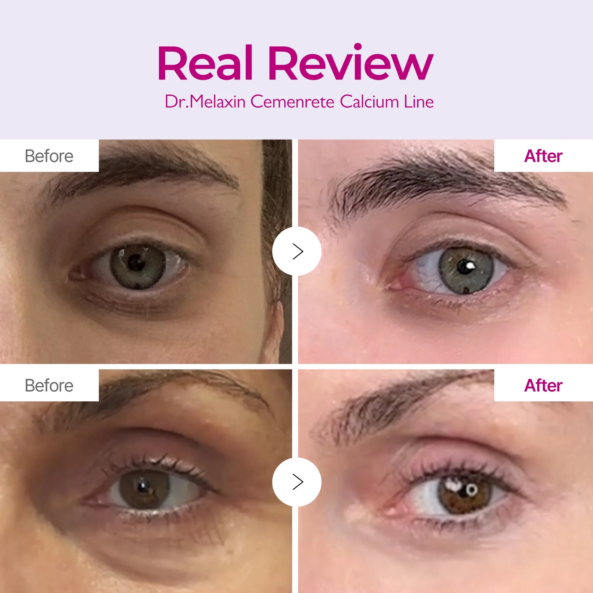 Dr.Melaxin Cemenrete EX Volume Firming — how to use