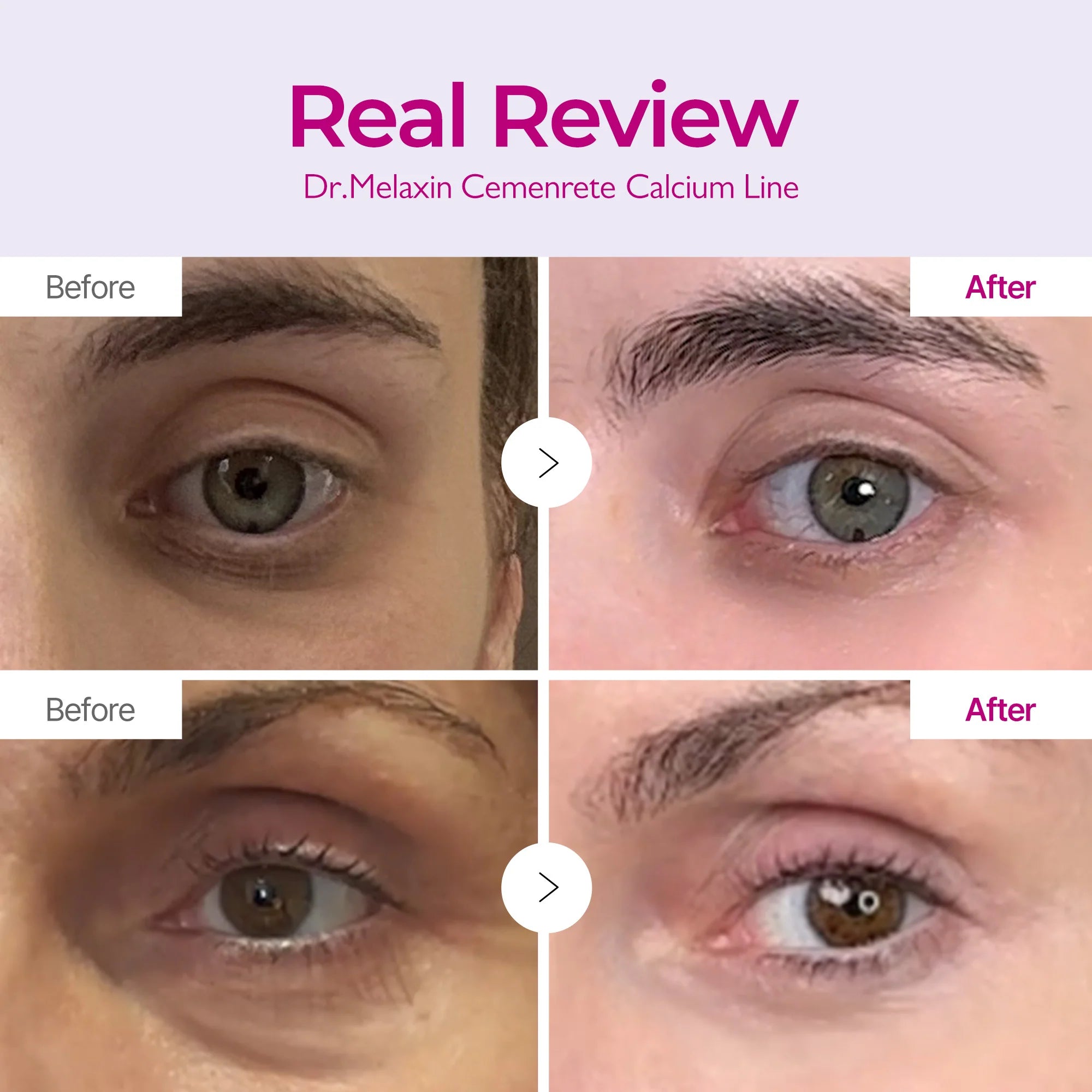 Dr.Melaxin Cemenrete EX Volume Firming — how to use