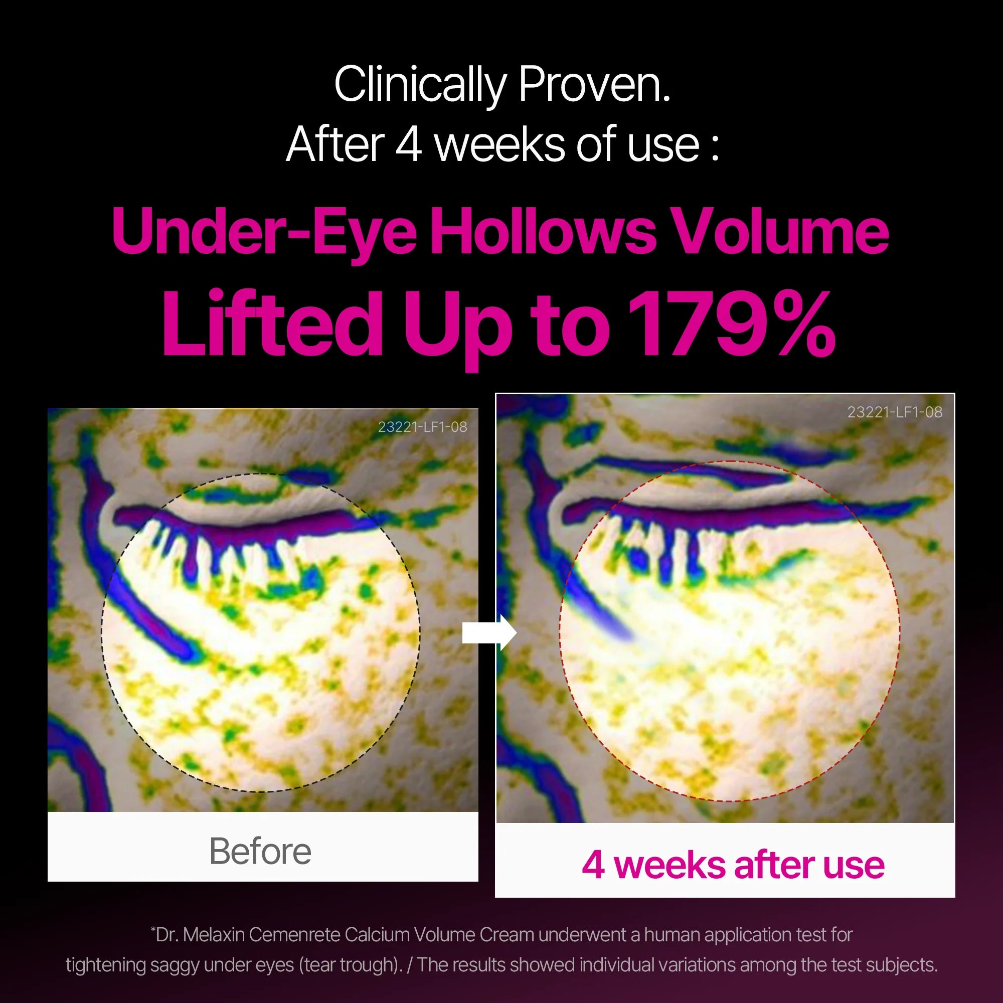 Dr.Melaxin Cemenrete EX Volume Firming — calcium complex