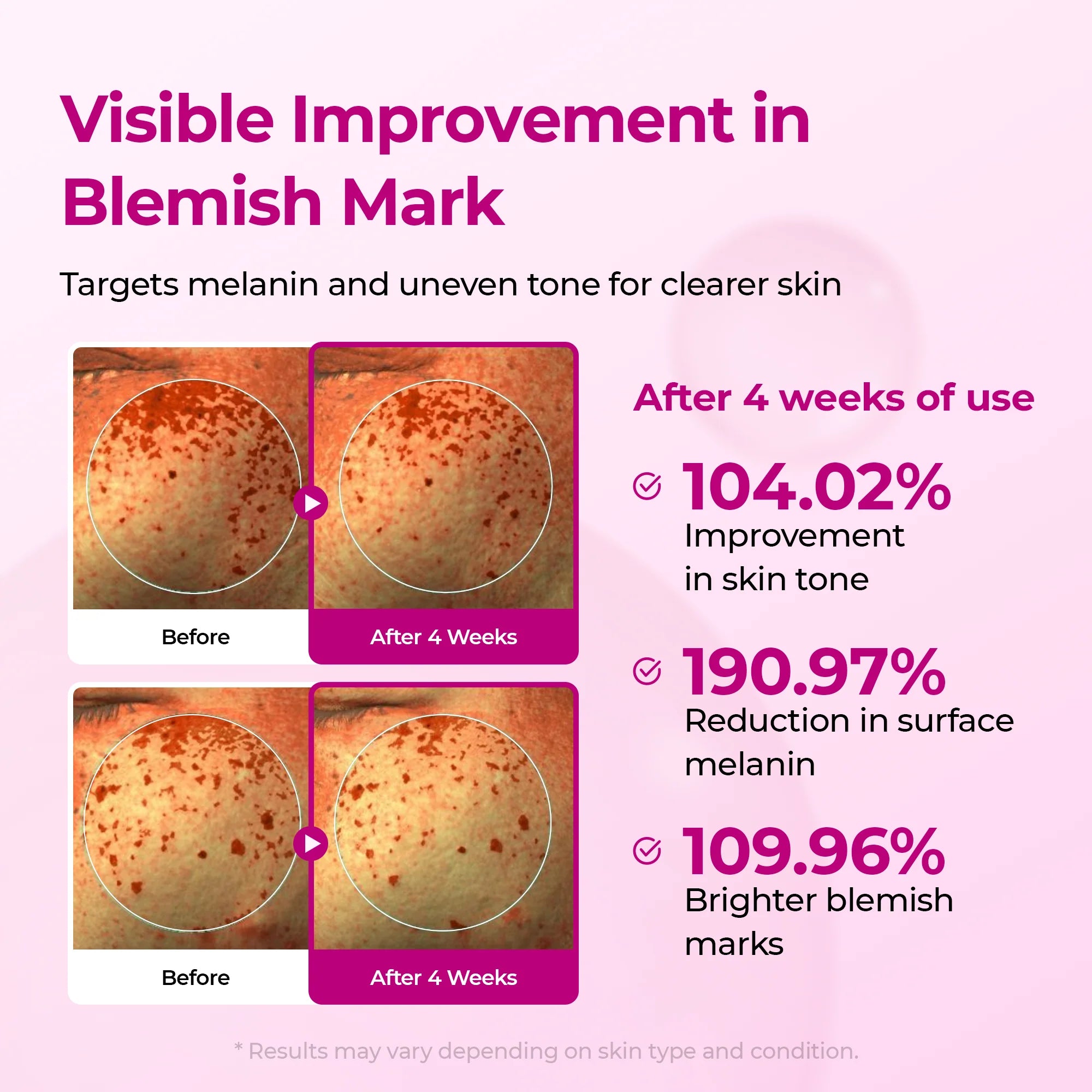 Dr.Melaxin Cemenrete Picotonic Shot Pigmentation Serum — fades pigmentation
