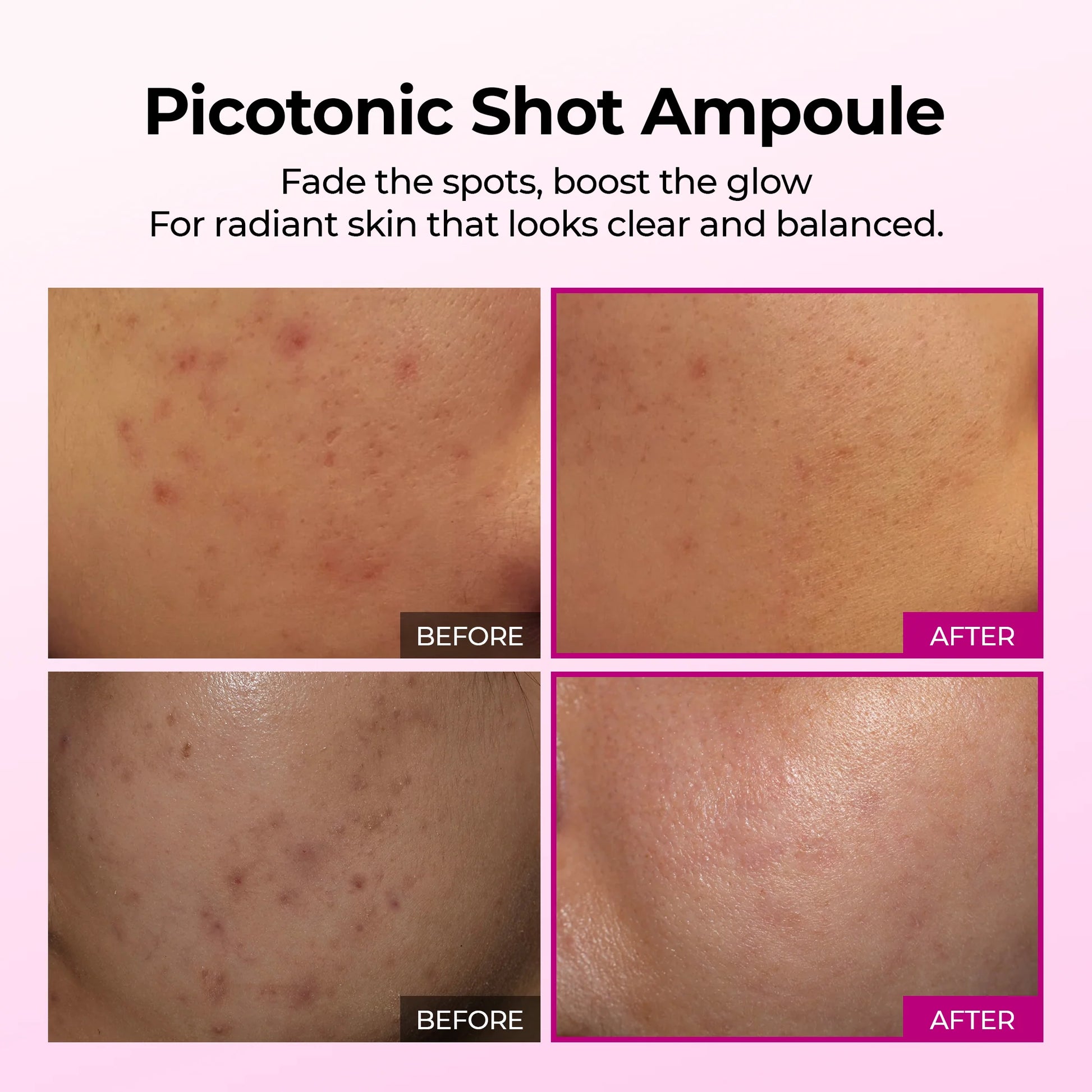 Dr.Melaxin Cemenrete Picotonic Shot Pigmentation Serum — brightening complex