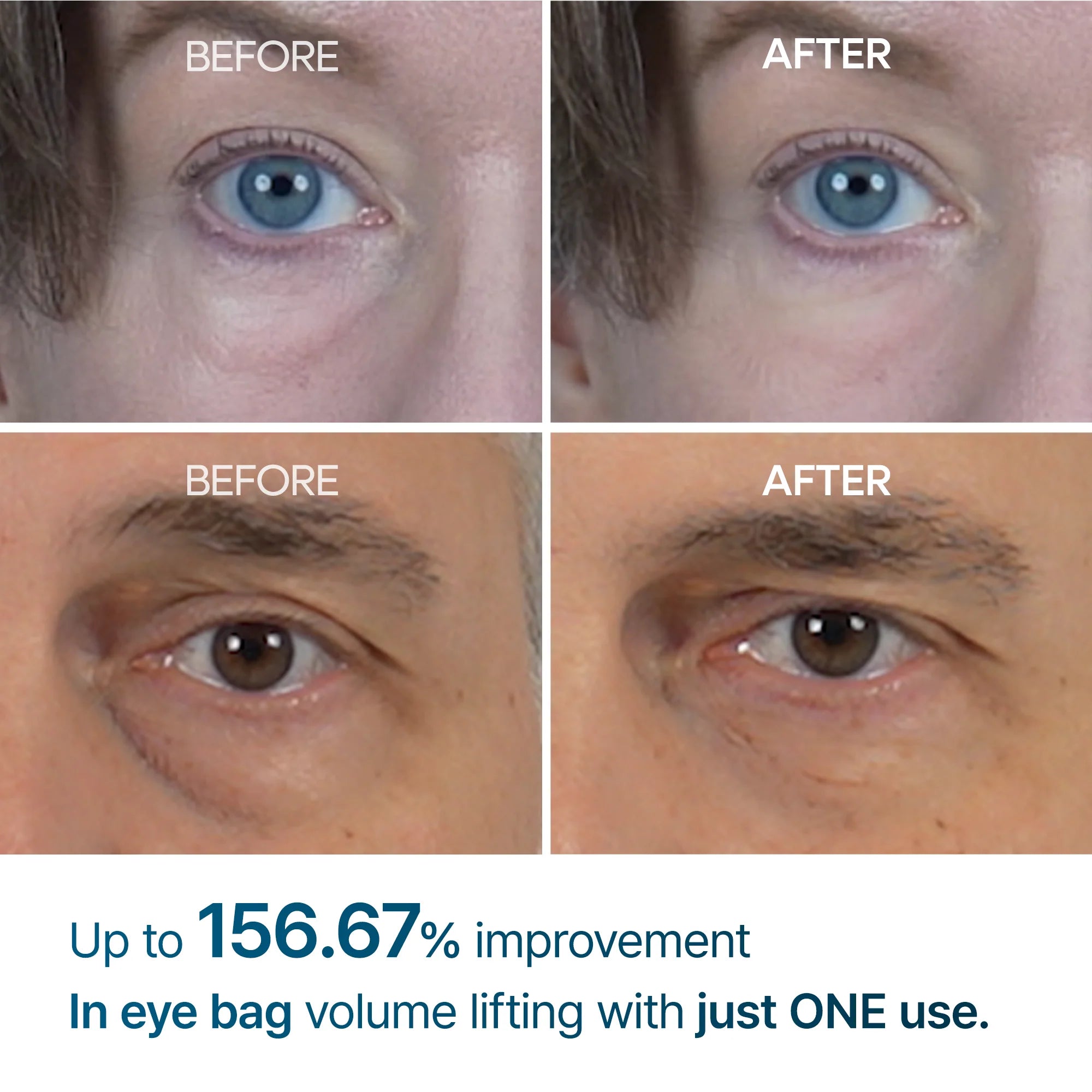 Dr.Melaxin Eyephalt Eyebag Cream — firming complex