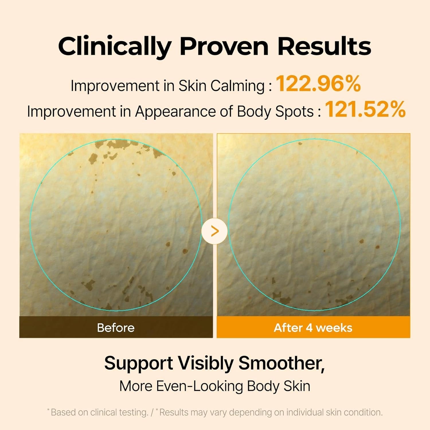 Dr.Melaxin Kojic Acid Turmeric Capsule Body Cream — kojic acid and turmeric