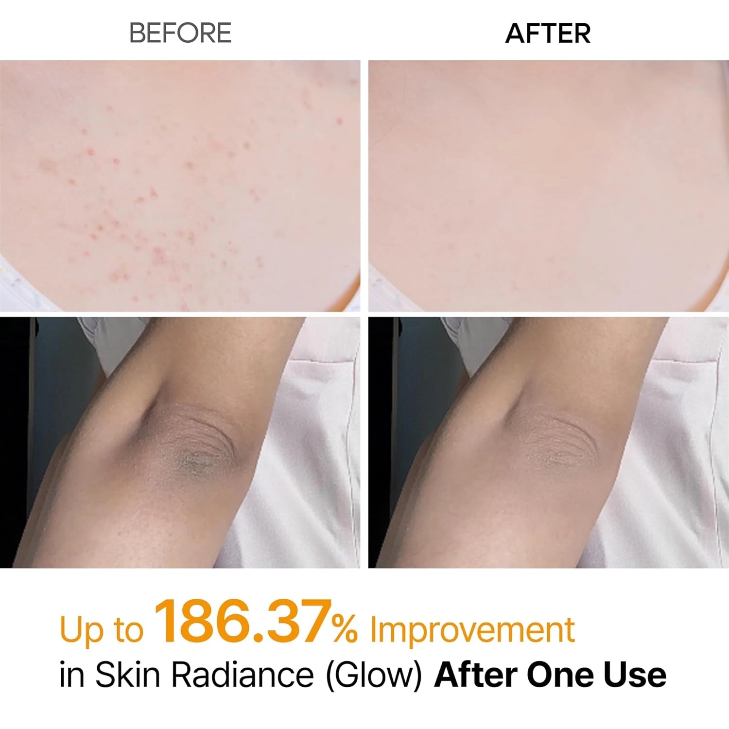 Dr.Melaxin Peel Shot Exfoliating Kojic Acid Turmeric Spray — kojic acid and turmeric