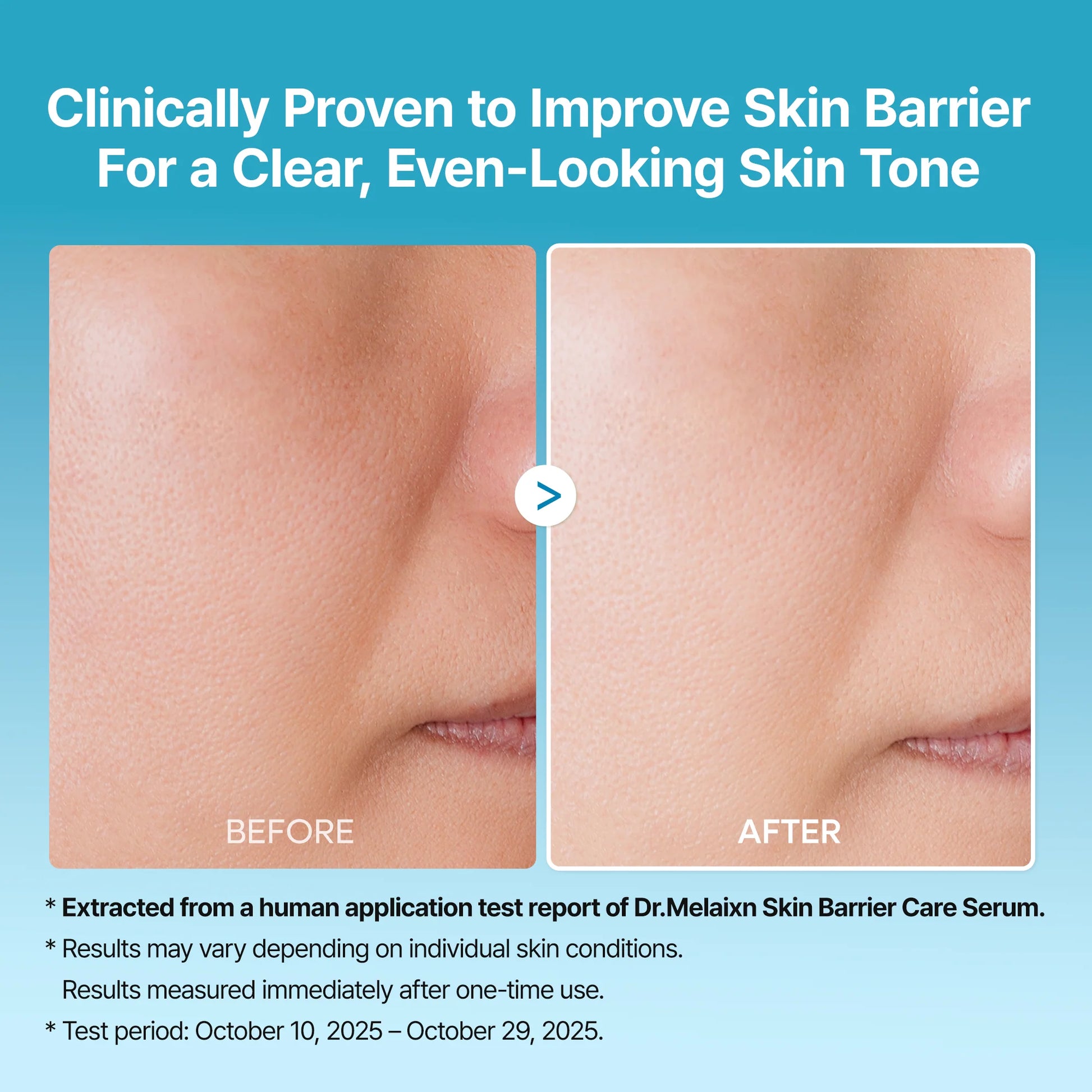 Dr.Melaxin Peel Shot Exfoliating TX Serum — even-toned skin