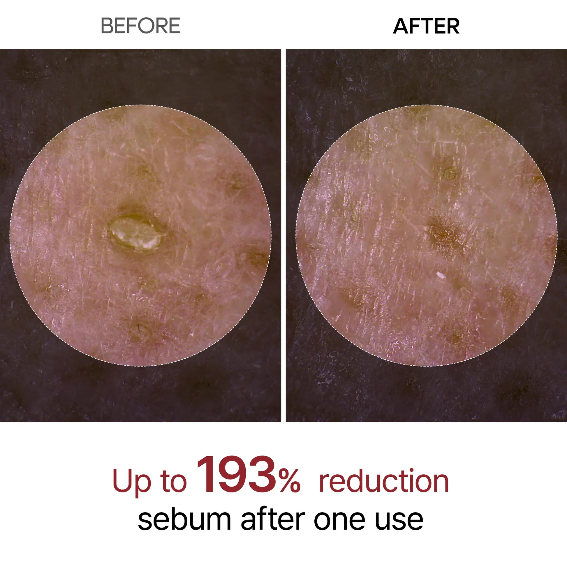 Dr.Melaxin Peel Shot Glow Black Rice Ampoule — black rice extract