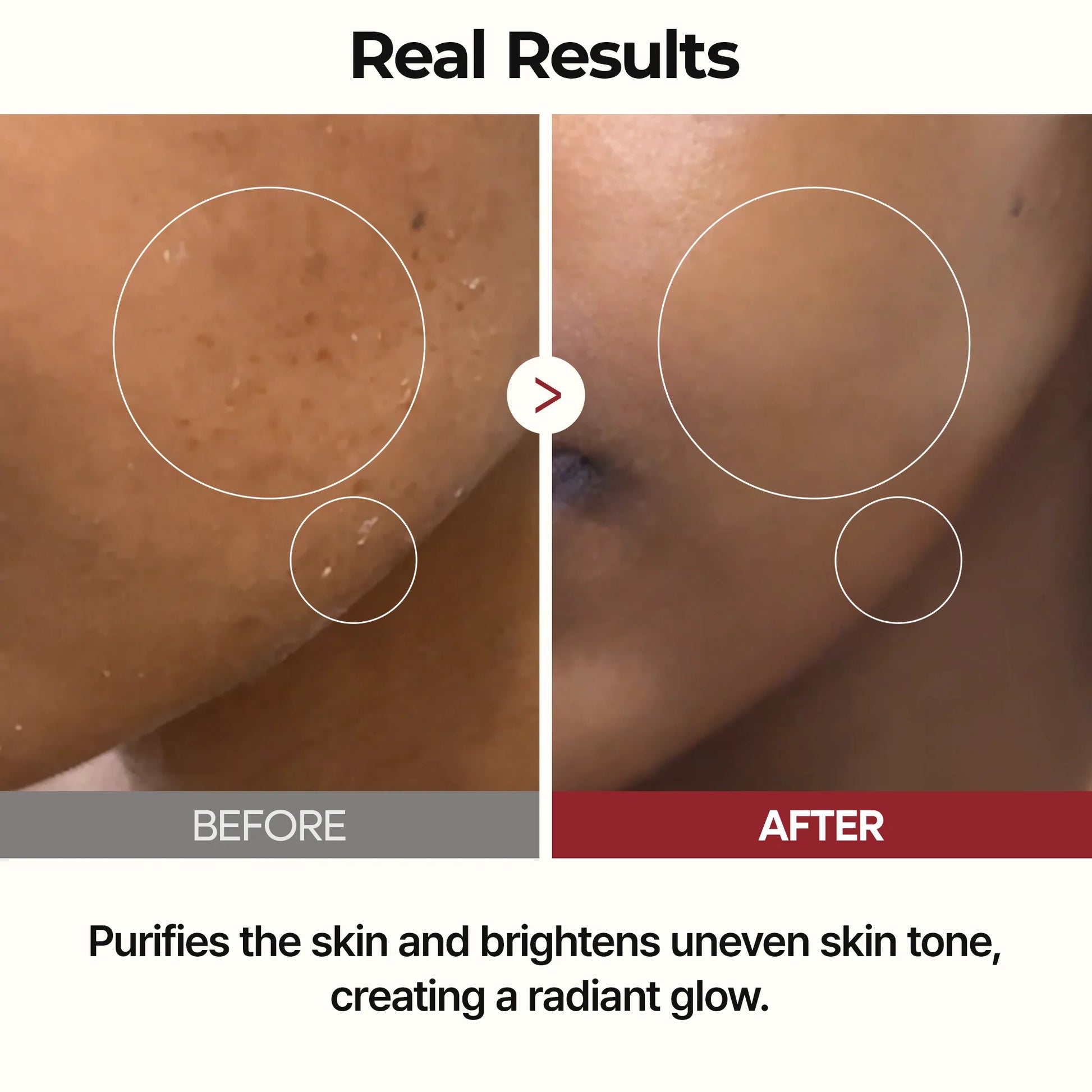 Dr.Melaxin Peel Shot Glow White Rice Toner — brightening glow