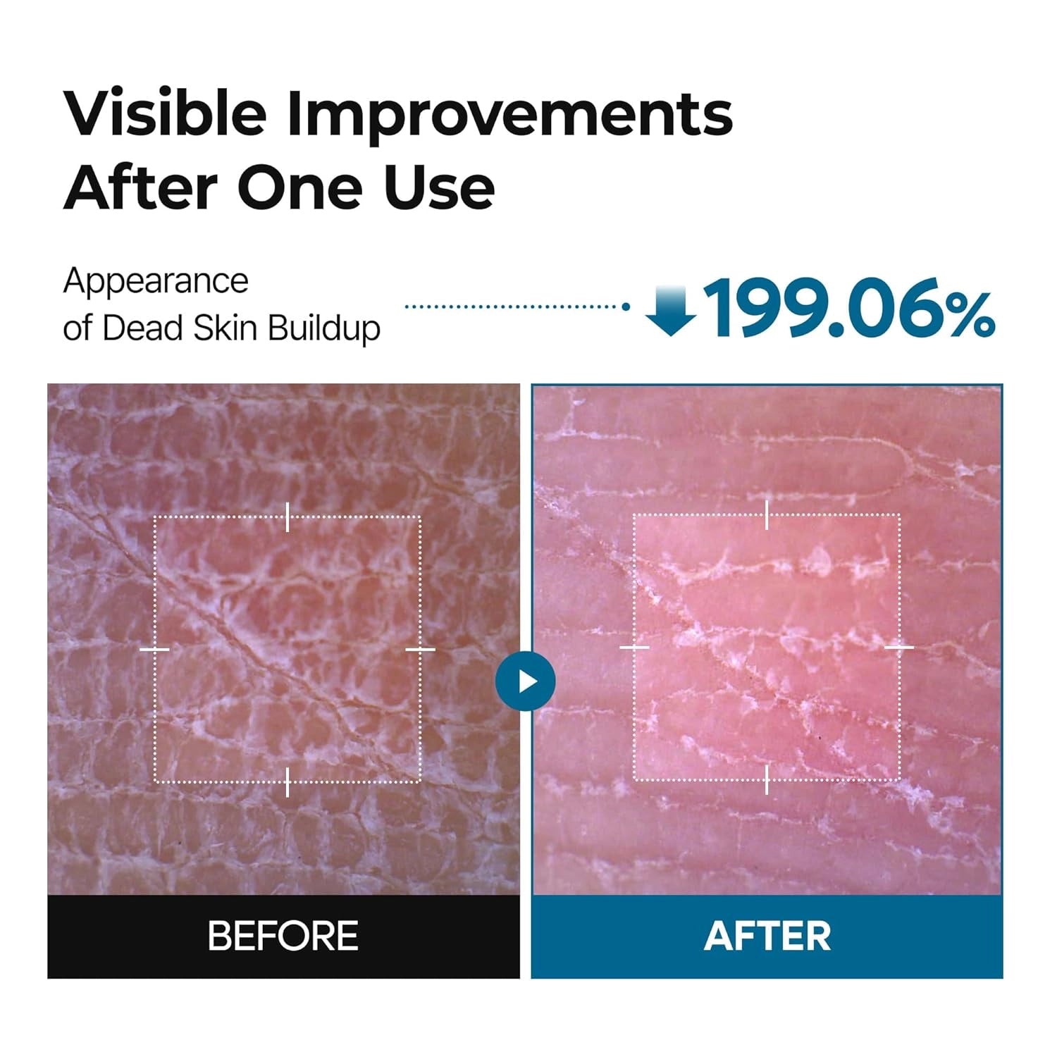 Dr.Melaxin Peel Shot PS Exfoliating TX Spray — tranexamic acid formula