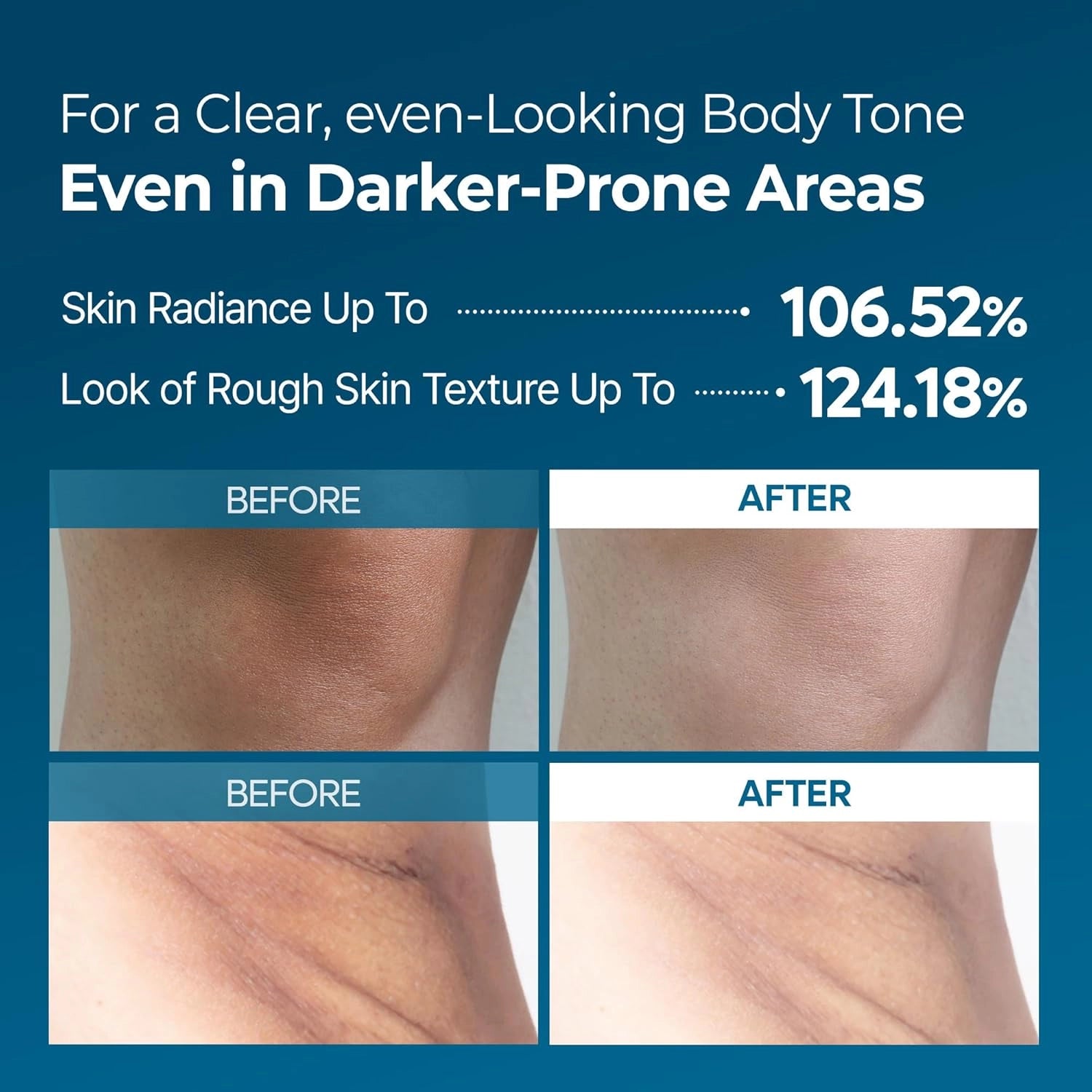 Dr.Melaxin Peel Shot PS Exfoliating TX Spray — even-toned smooth skin