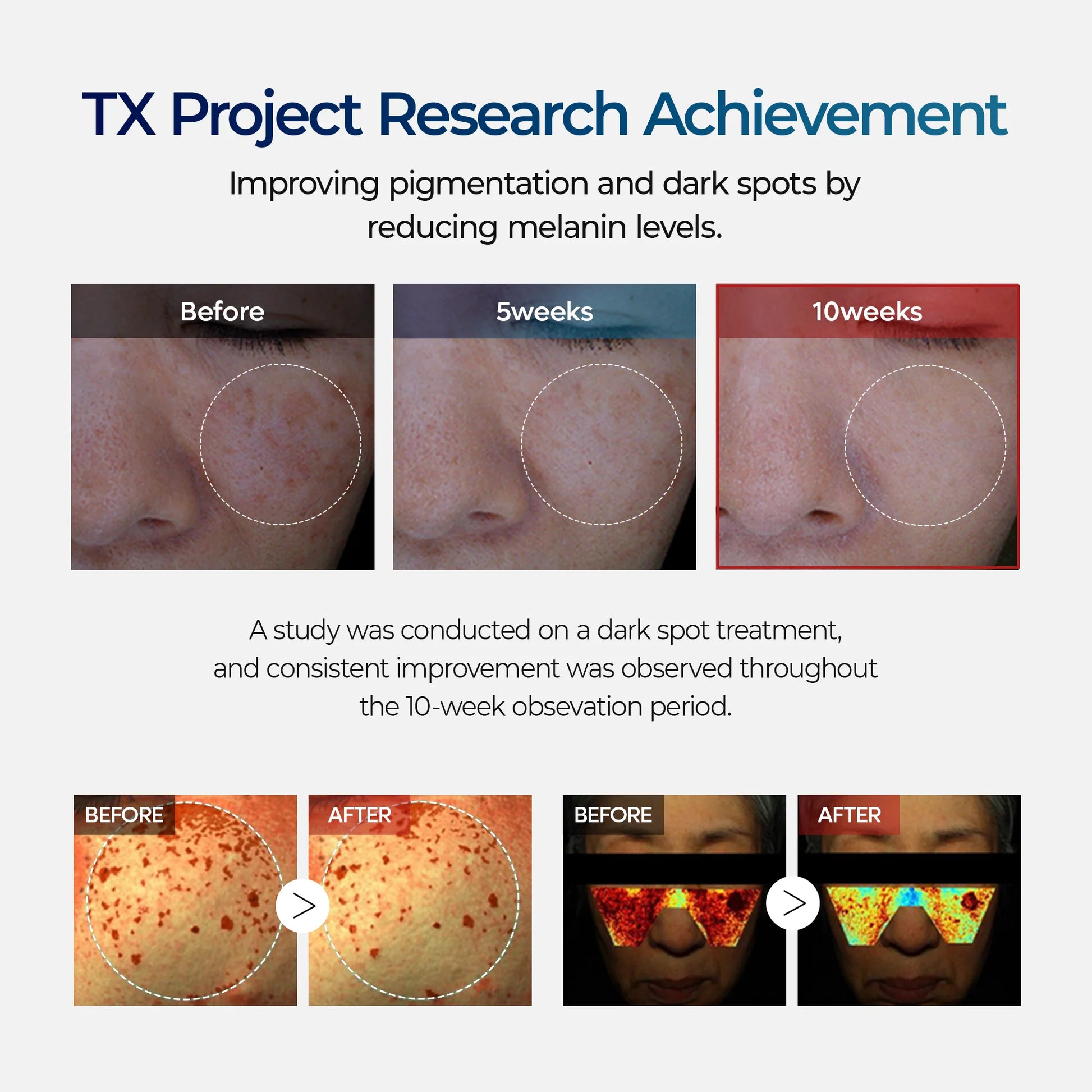 Dr.Melaxin TX Tranexamic Acid Cream — application