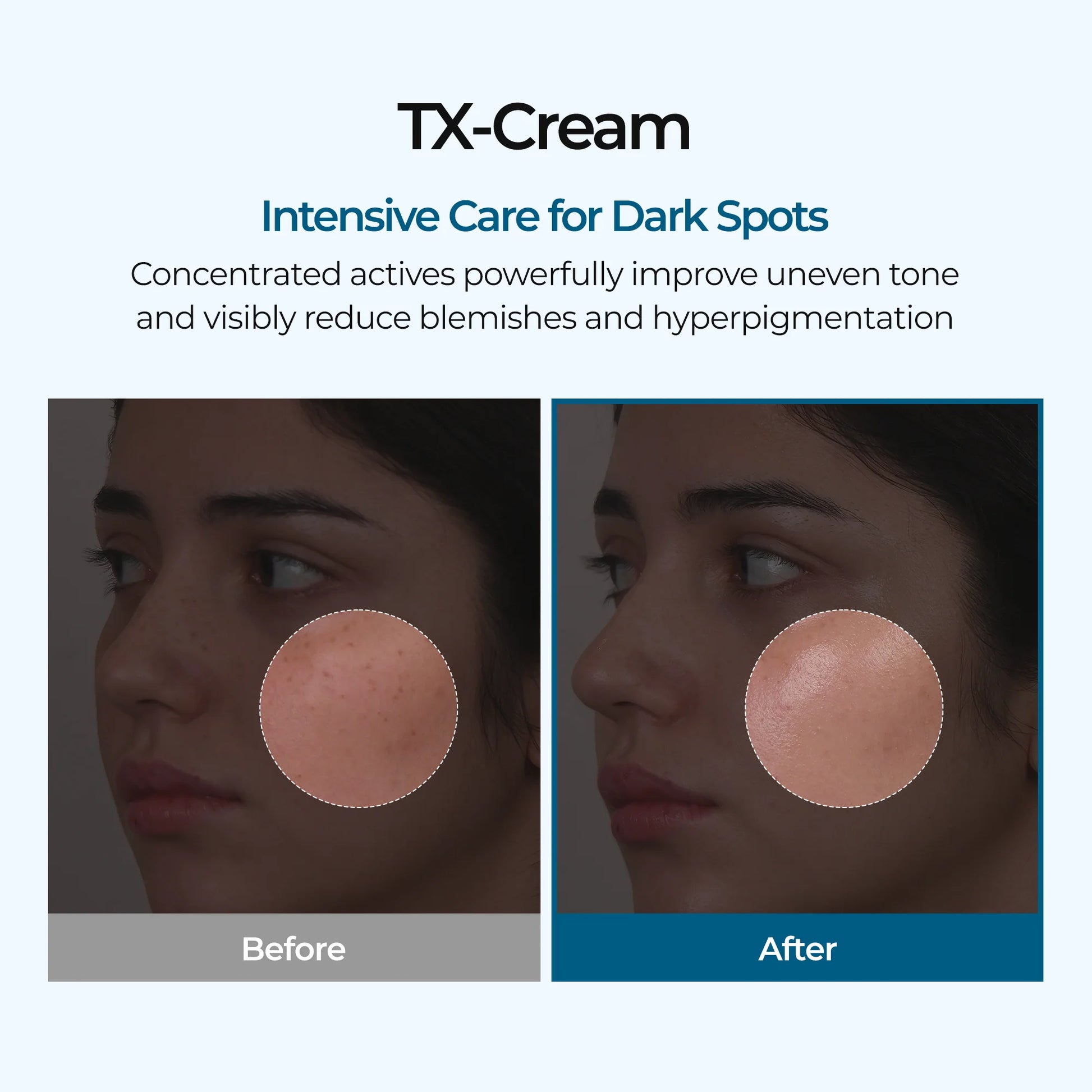 Dr.Melaxin TX Tranexamic Acid Cream — tranexamic acid formula