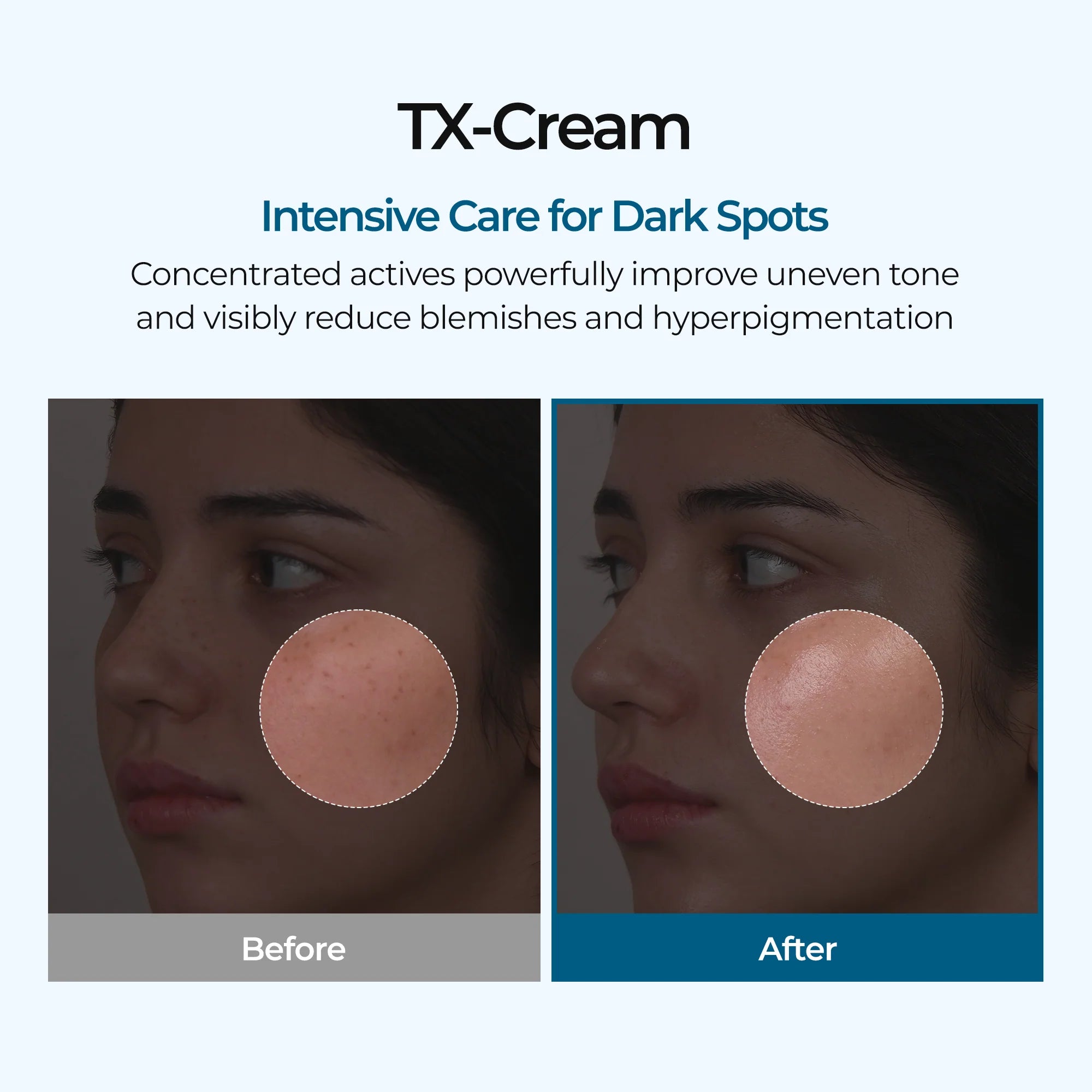 Dr.Melaxin TX Tranexamic Acid Cream — tranexamic acid formula