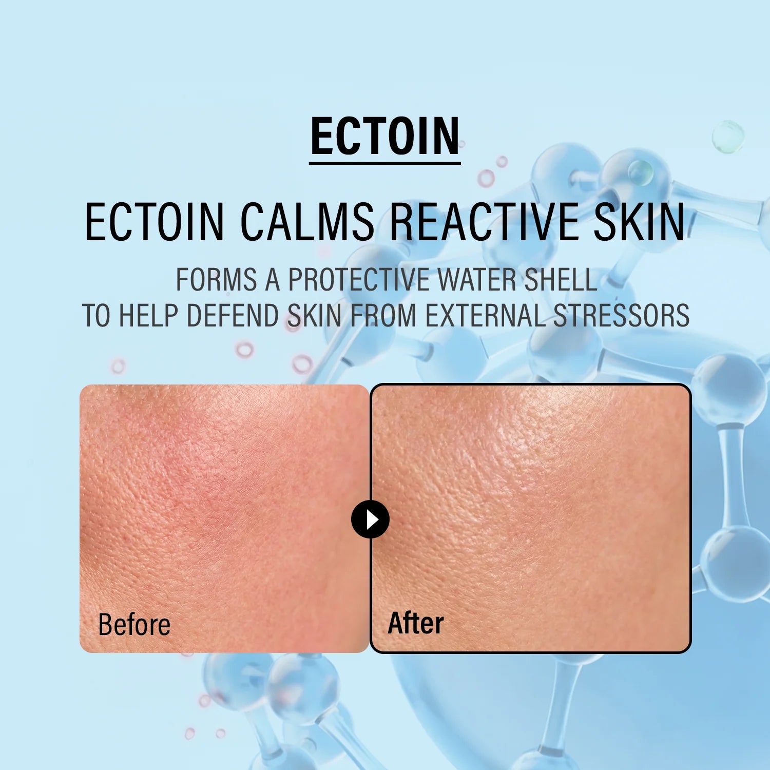 epii Double Up Cream Ectoin & Panthenol – calms redness