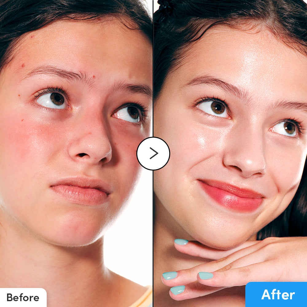 EQQUALBERRY Hyaltoin Flooding Serum — 11 hyaluronic acids