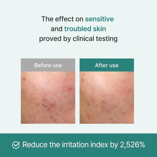 I'm from Licorice Calming Cream strengthens the moisture barrier