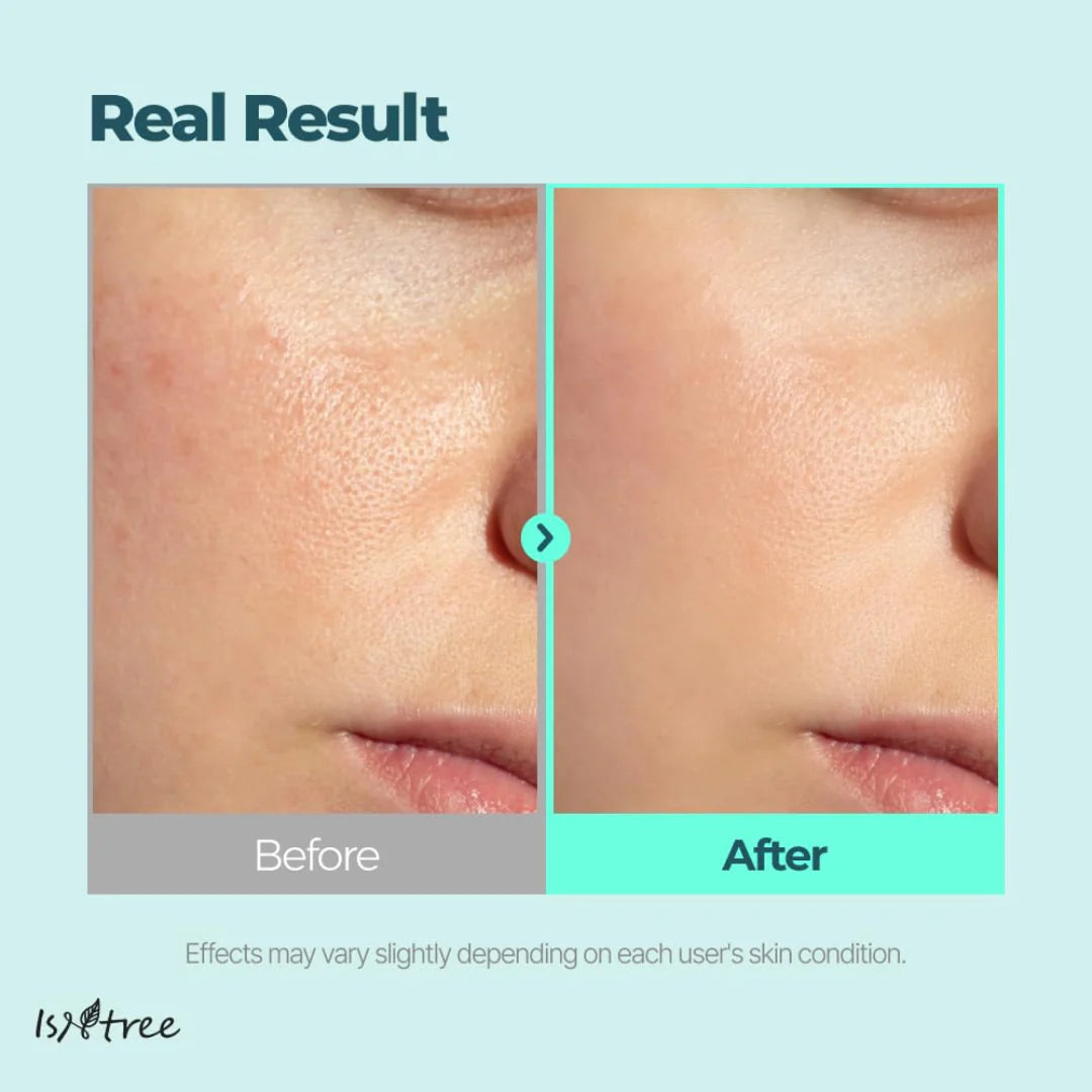 Isntree Gim PDRN Hydro Bouncy Ampoule — PDRN hydrating bouncy ampoule