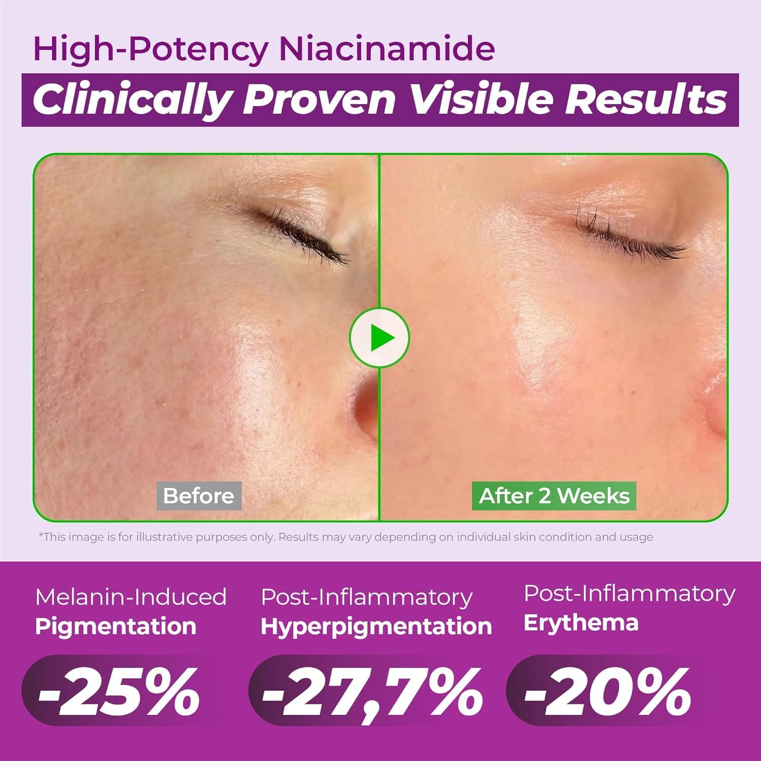 Apply a few drops after toner before moisturizer