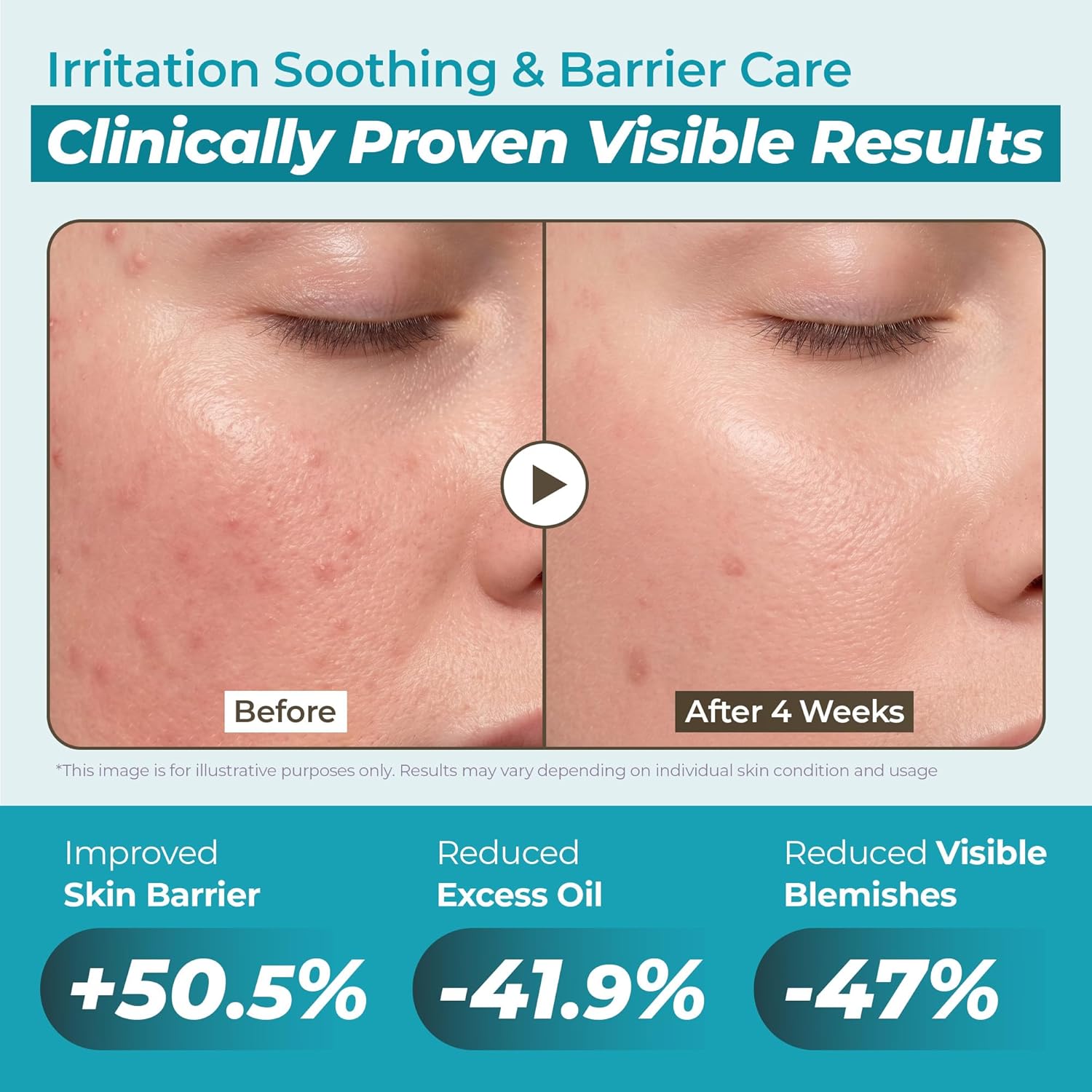 Locks in moisture for soft, supple skin