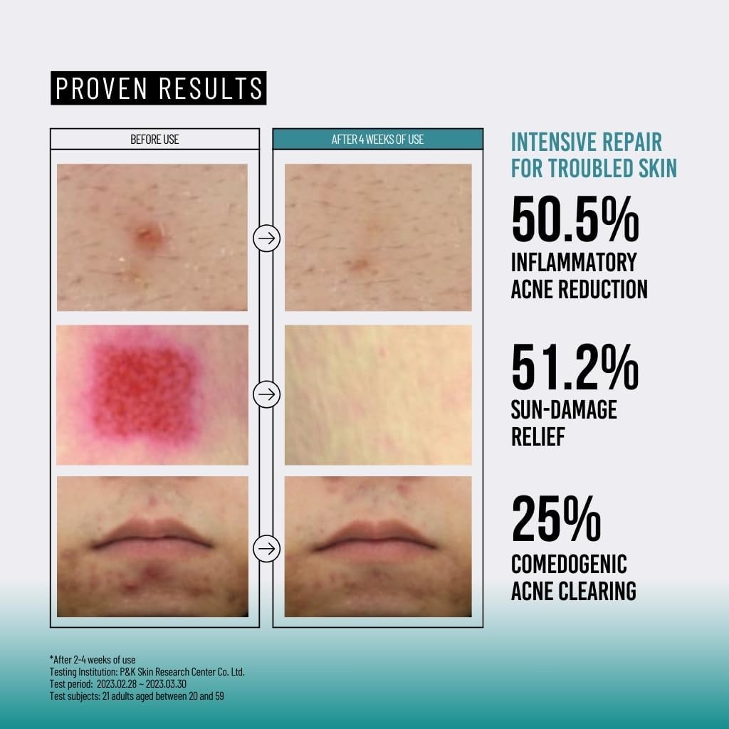 Deeply hydrates and plumps dull, tired skin