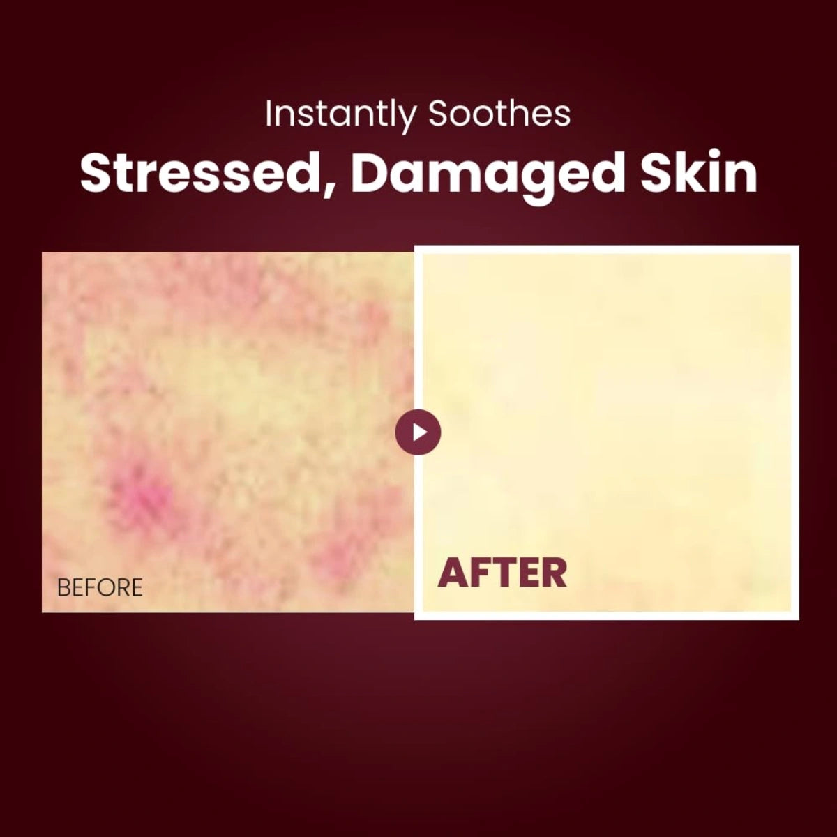 Skin looks calmer, healthier and more resilient over time