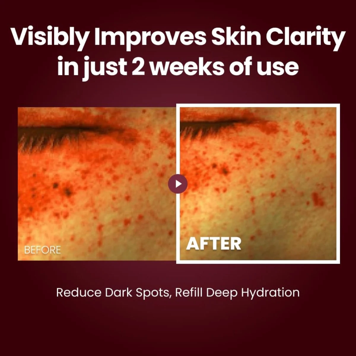 Kopher Curepair Solution — soothing, barrier-balancing daily treatment