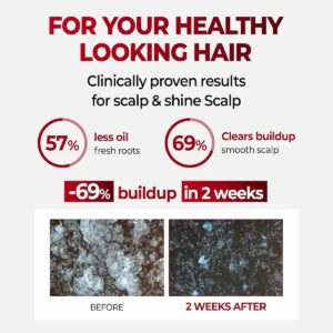 KUNDAL Natural Caffeine Hair Care Shampoo Baby Powder — caffeine and baby powder scent