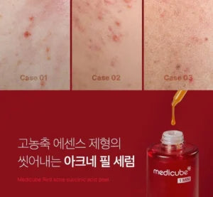 Medicube Red Acne Succinic Acid Peel