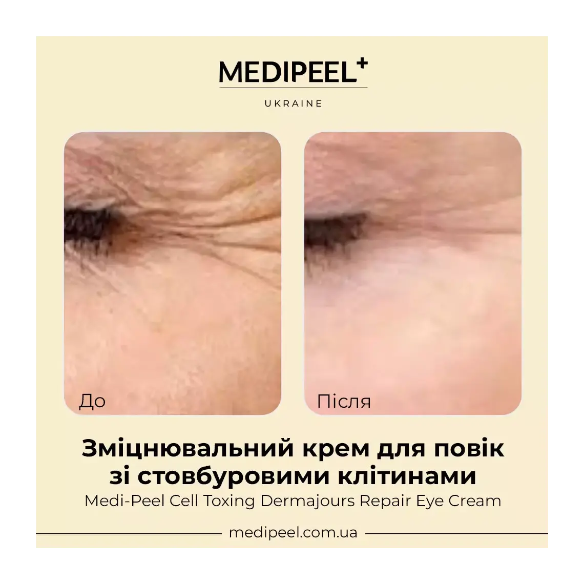 MEDI-PEEL Cell Toxing Dermajours Repair Eye Cream — helps reduce the look of fine lines and wrinkles