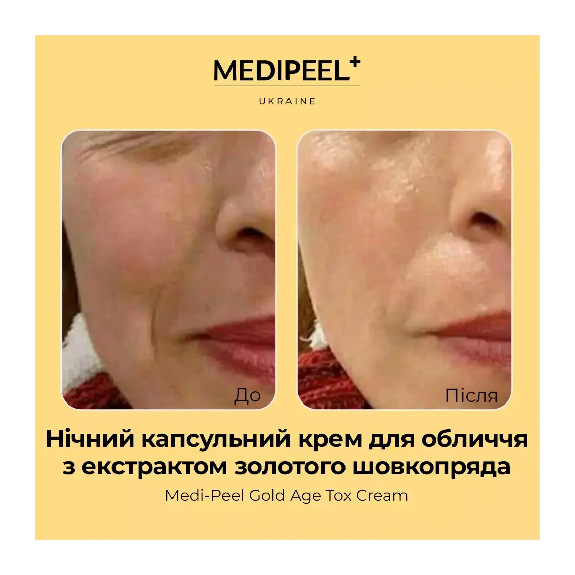 MEDI-PEEL Gold Age Tox H8 Cream — firms for a more lifted, youthful look