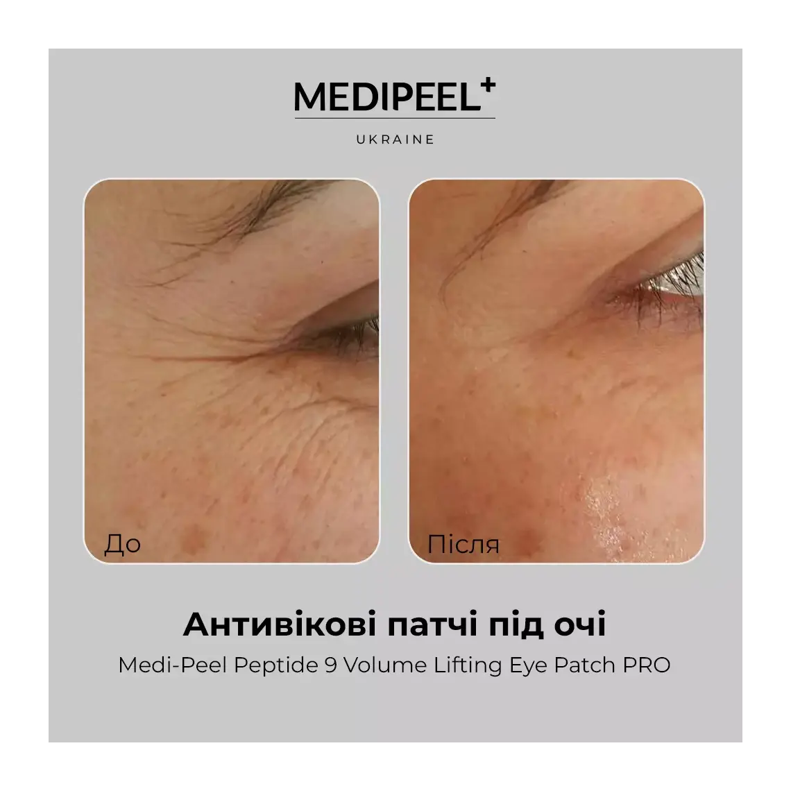 MEDI-PEEL Peptide 9 Volume Lifting Eye Patch Pro — peptides firm and lift the under-eye area