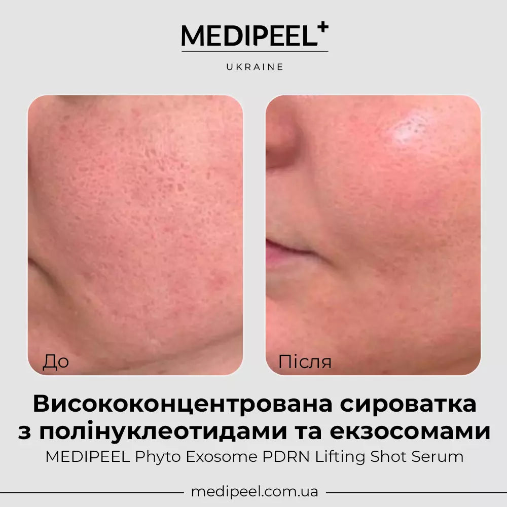 MEDI-PEEL Phyto Exosome PDRN Lifting Shot Serum — smooths the look of fine lines and wrinkles