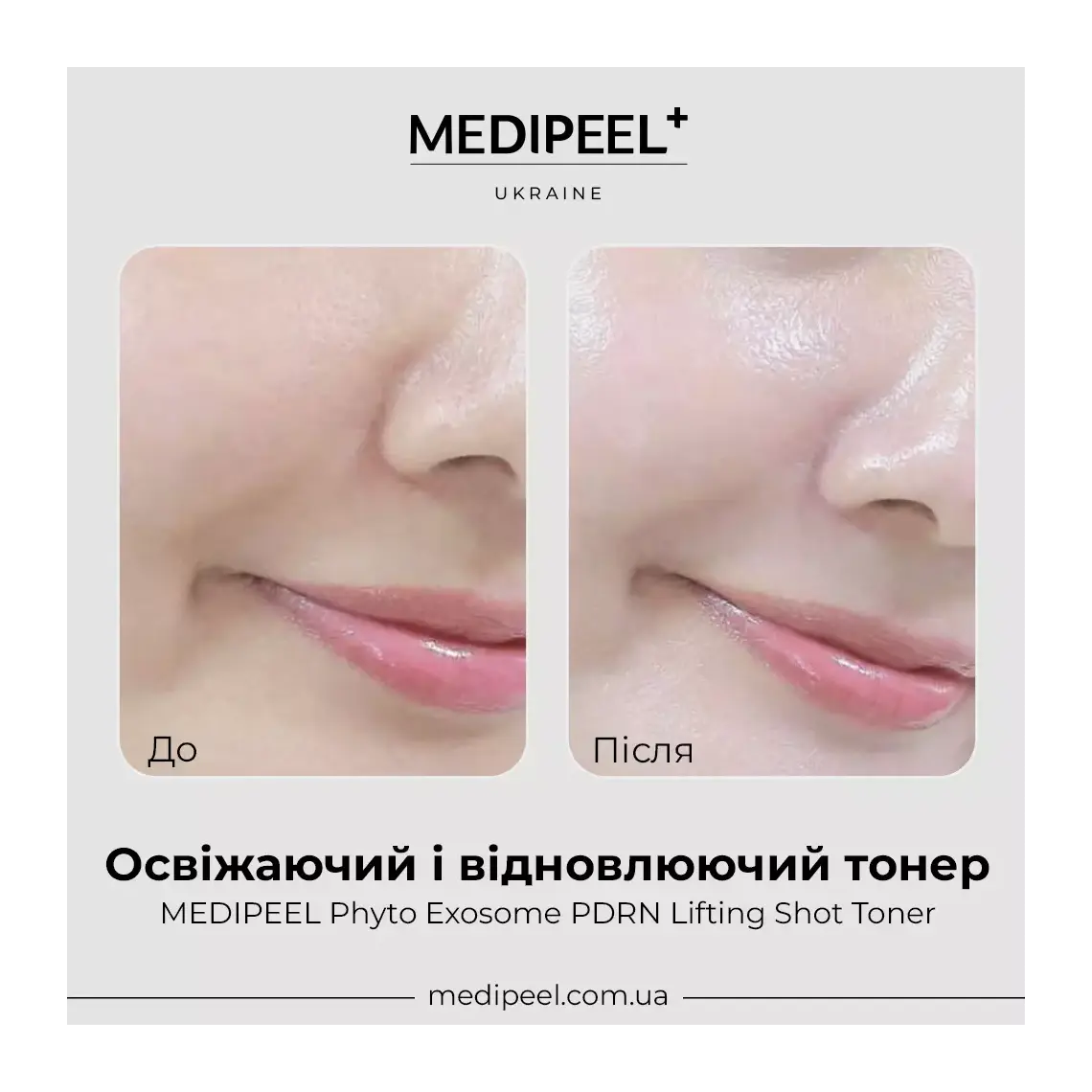 MEDI-PEEL Phyto Exosome PDRN Lifting Shot Toner — preps and hydrates skin after cleansing