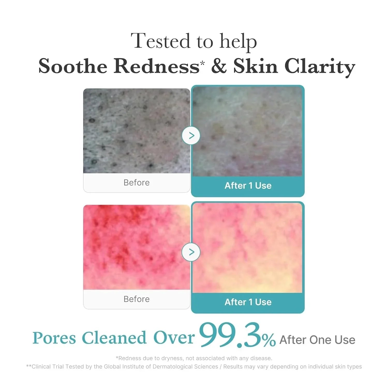 Azelaic Acid Niacinamide Deep Cleansing Foam daily foaming cleanser