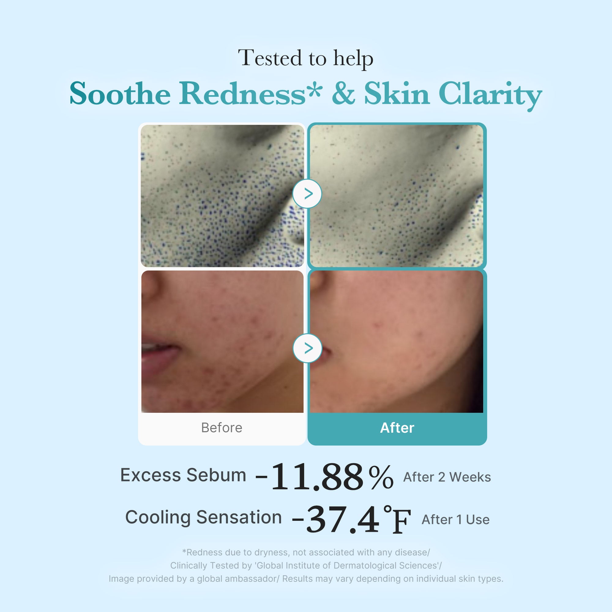 Lightweight watery toner that balances oil and moisture for clearer skin