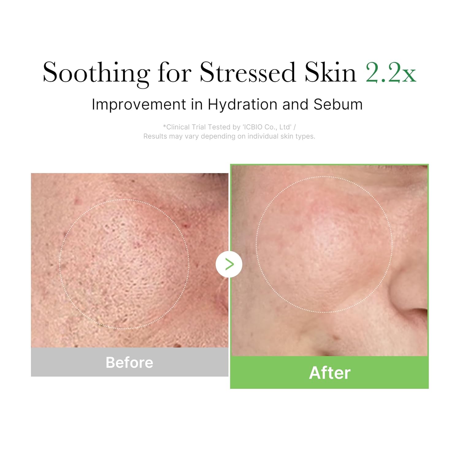 Fragrance-free Exosome Cica cream that controls sebum and strengthens the skin barrier for all skin types
