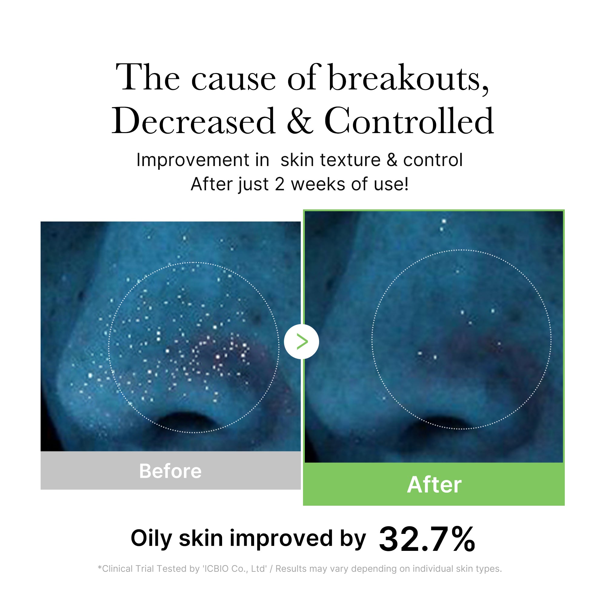Heartleaf and tea tree that balance oil and moisture for sebum and pore care