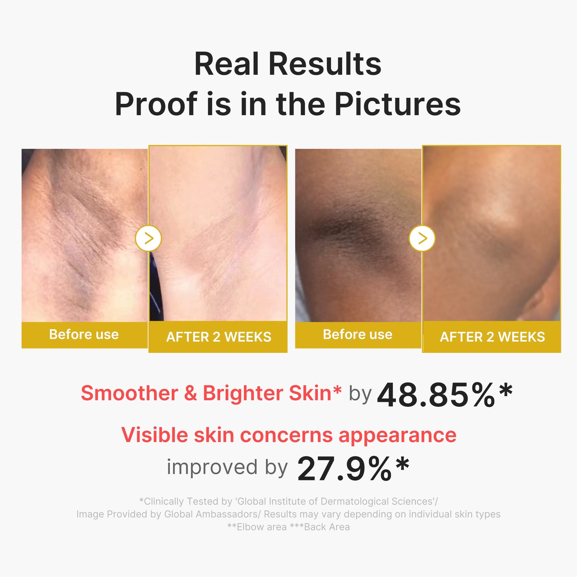 BHA, LHA and PHA that remove dead skin and smooth rough, bumpy body skin