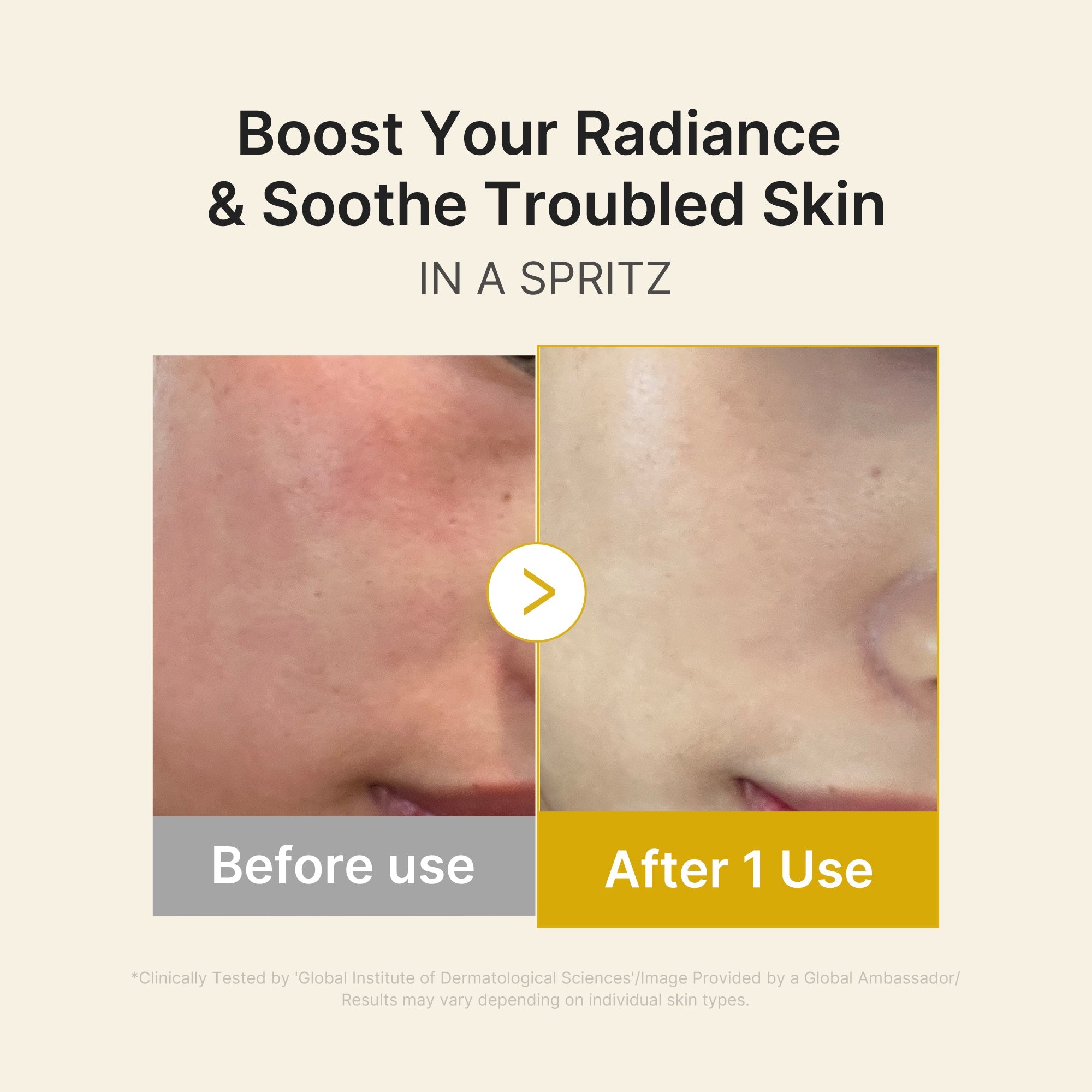 Kojic acid and turmeric that fade dark spots and even uneven tone