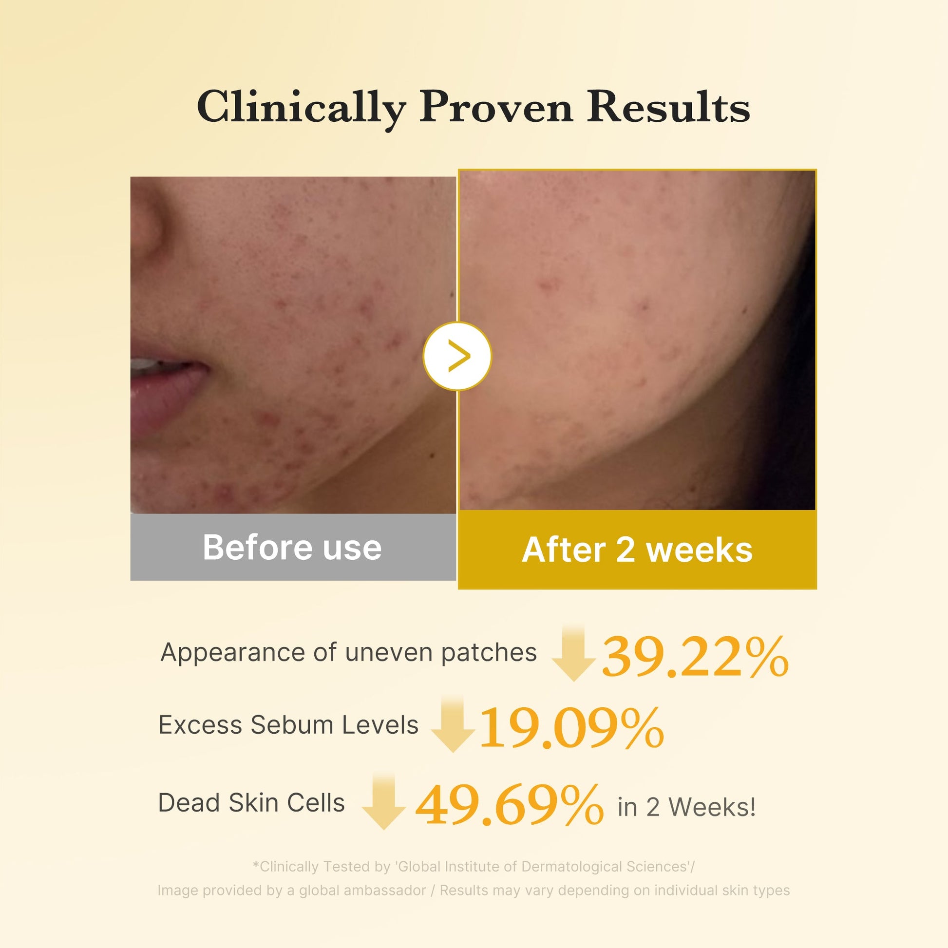 Kojic acid and turmeric that fade dark spots and acne scars