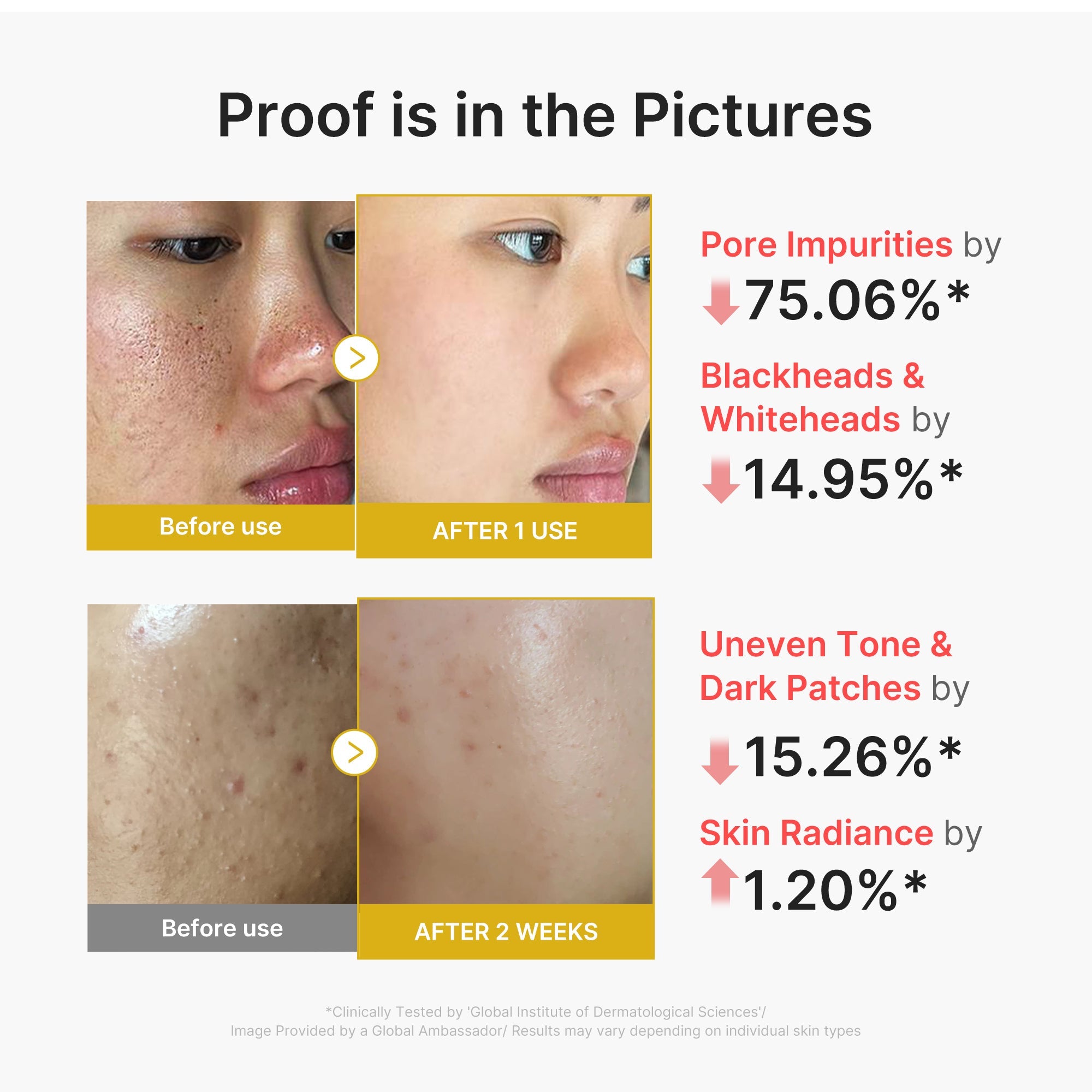 BHA, LHA and PHA that remove dead skin cells and excess sebum