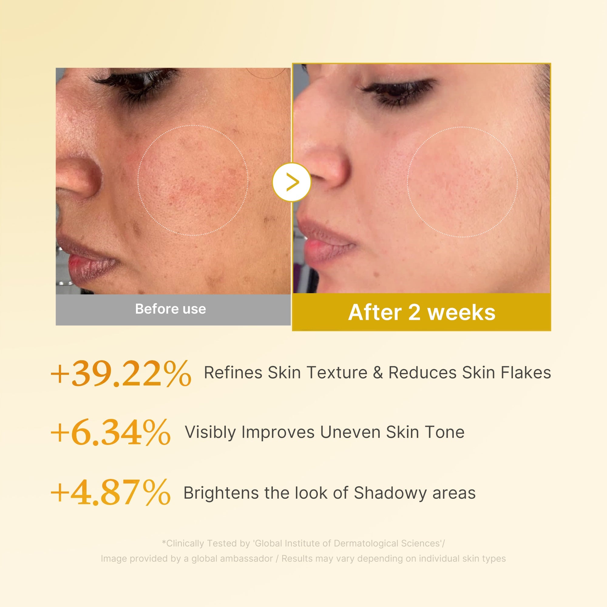 Kojic acid and turmeric that brighten dark spots and even skin tone
