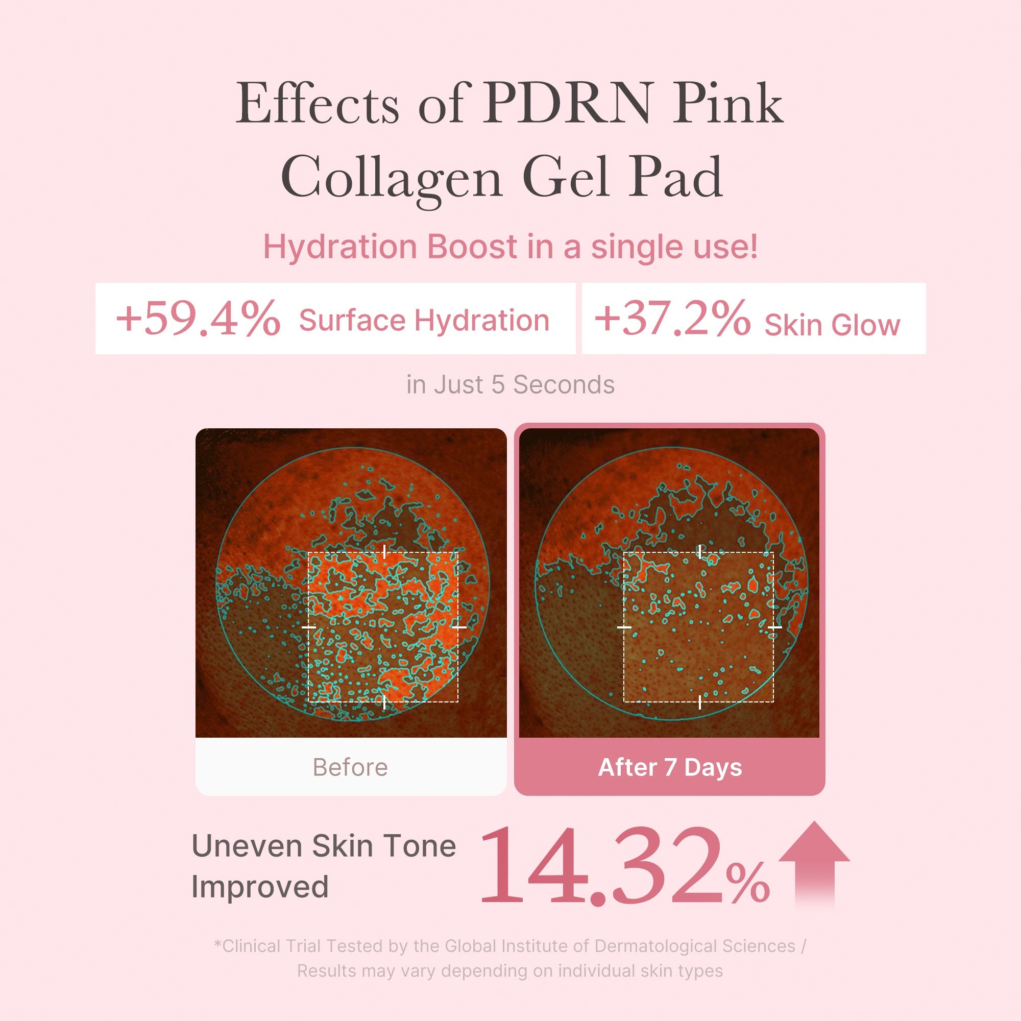 Ultra-thin jelly pads that target dark spots and refine uneven texture