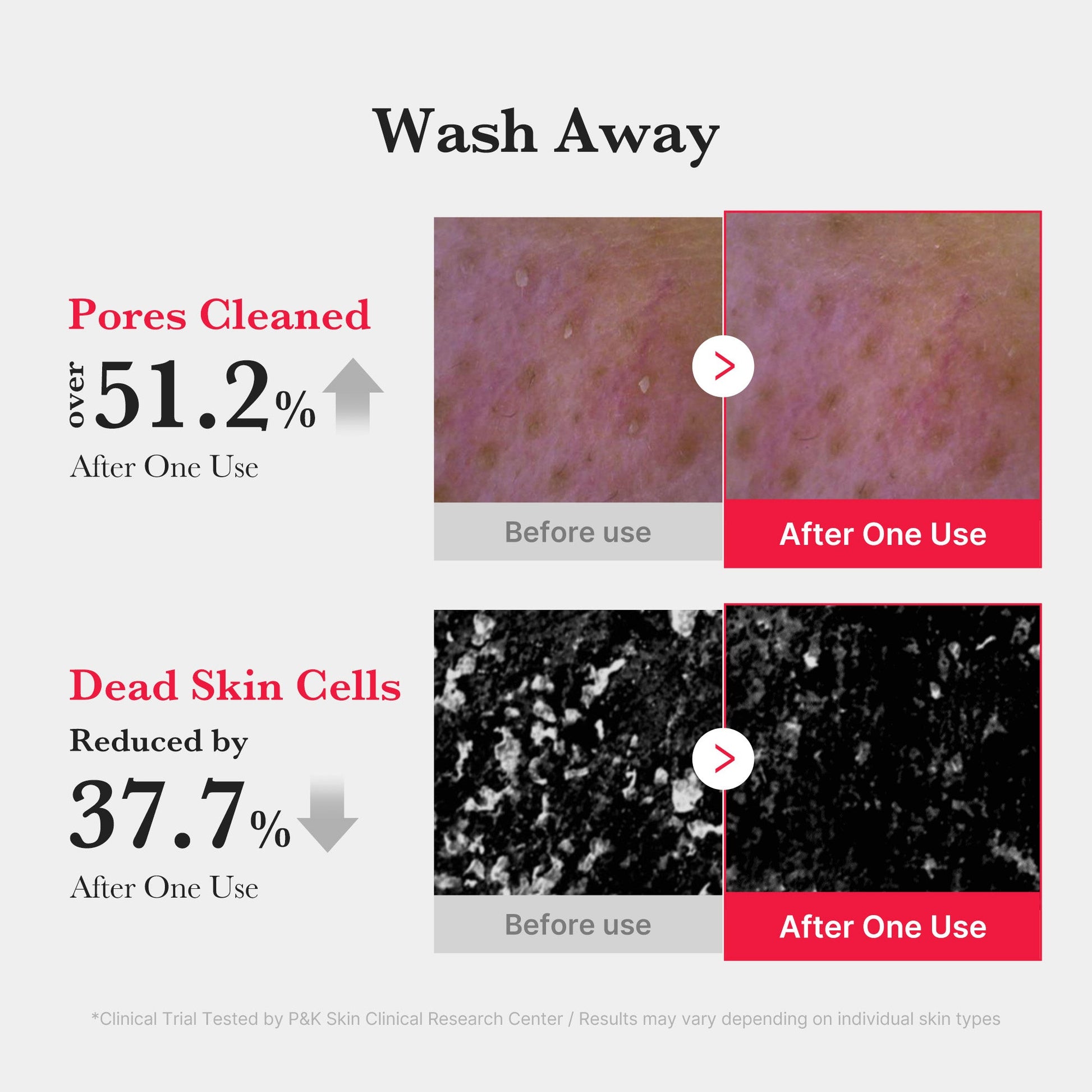 Salicylic acid that dissolves sebum and helps clear blackheads and whiteheads