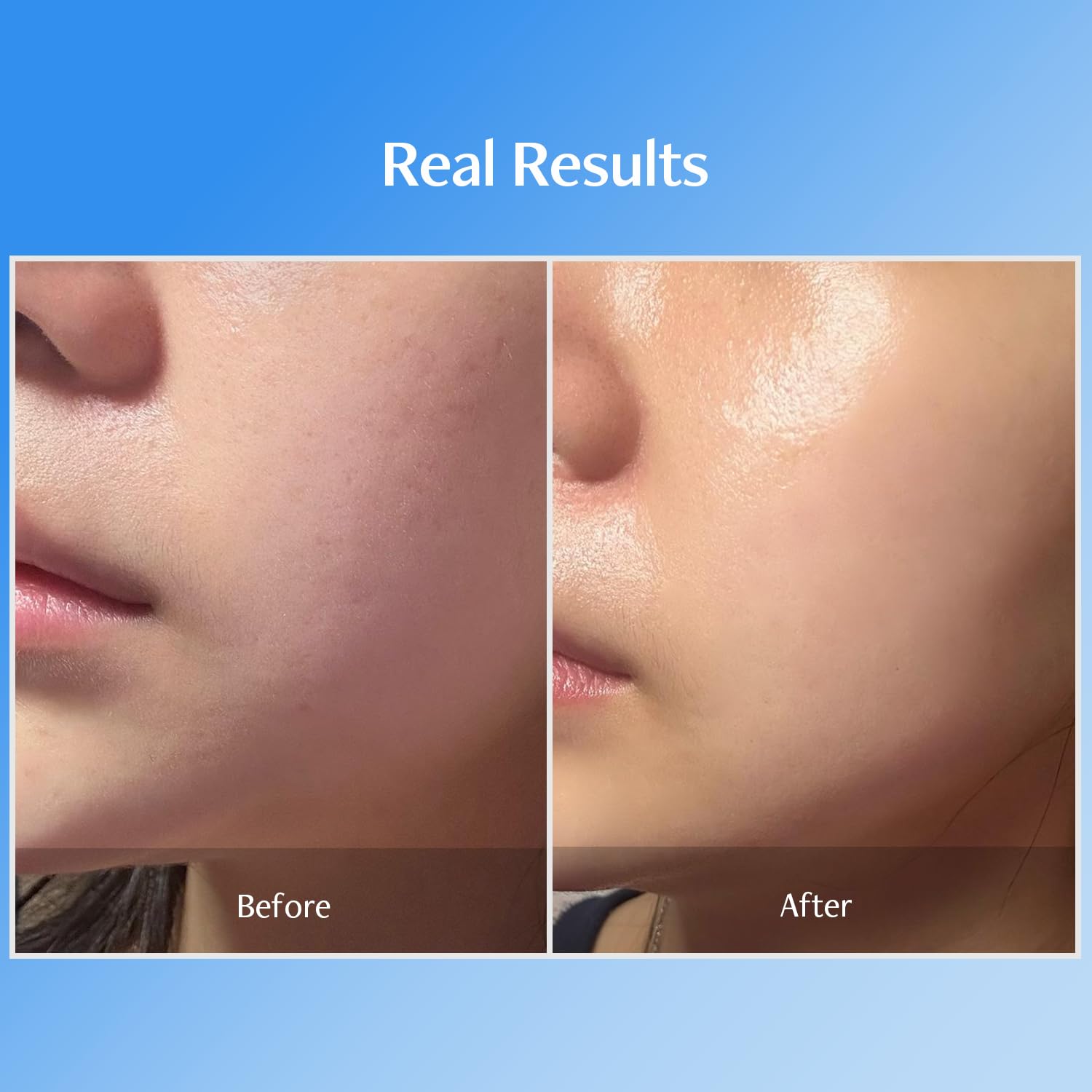 MEDITHERAPY Bluelayer Double Water Cream — helps strengthen the skin's moisture barrier