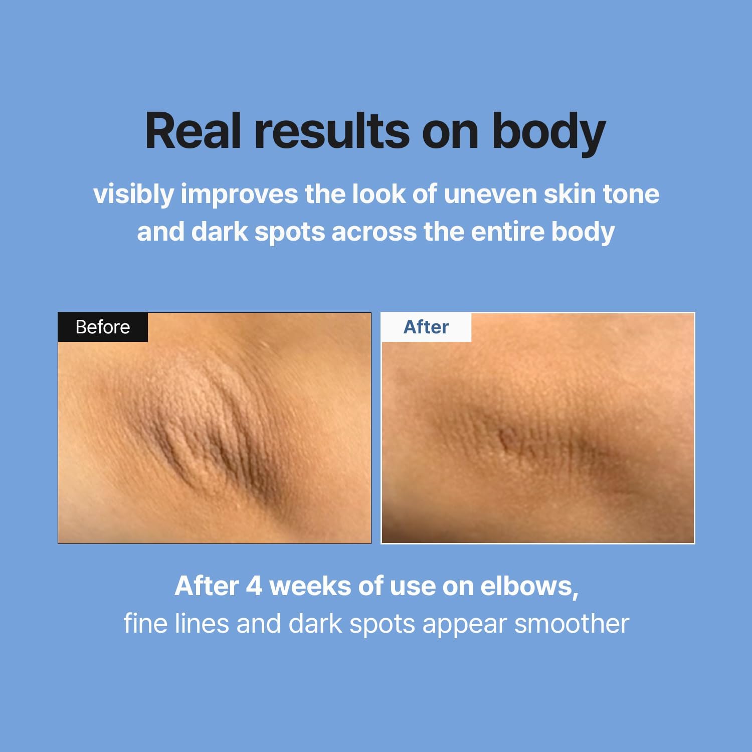 MEDITHERAPY Retinal Skin Booster Serum — improves the look of skin texture and tone