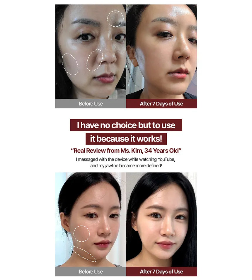 mommy care EMS V-THERA White Edition — lifted firm skin
