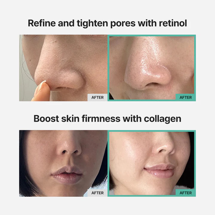 mommy care Green Collagen Boosting Gel — gel texture