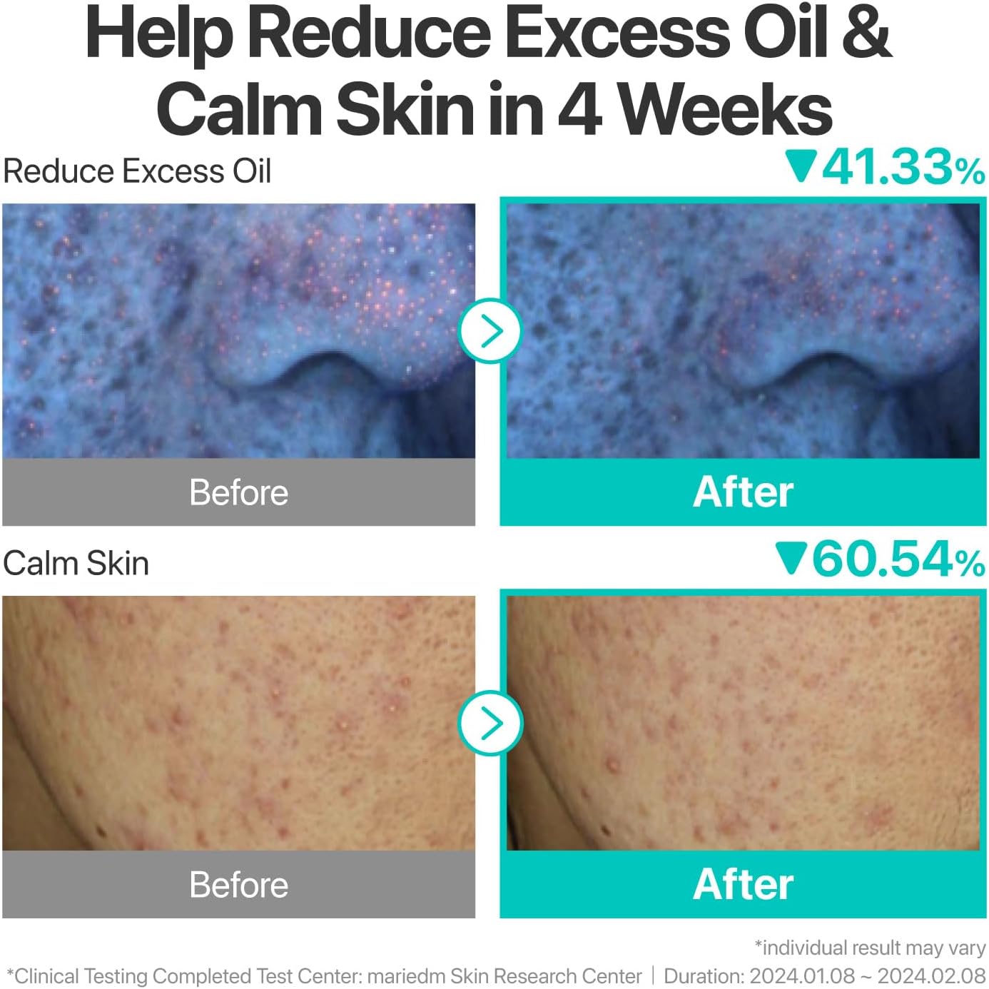 Numbuzin No.1 Pantothenic B5 Active Soothing Cream — pantothenic acid (B5) supports skin recovery